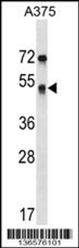 Western blot analysis in A375 cell line lysates (35ug/lane).