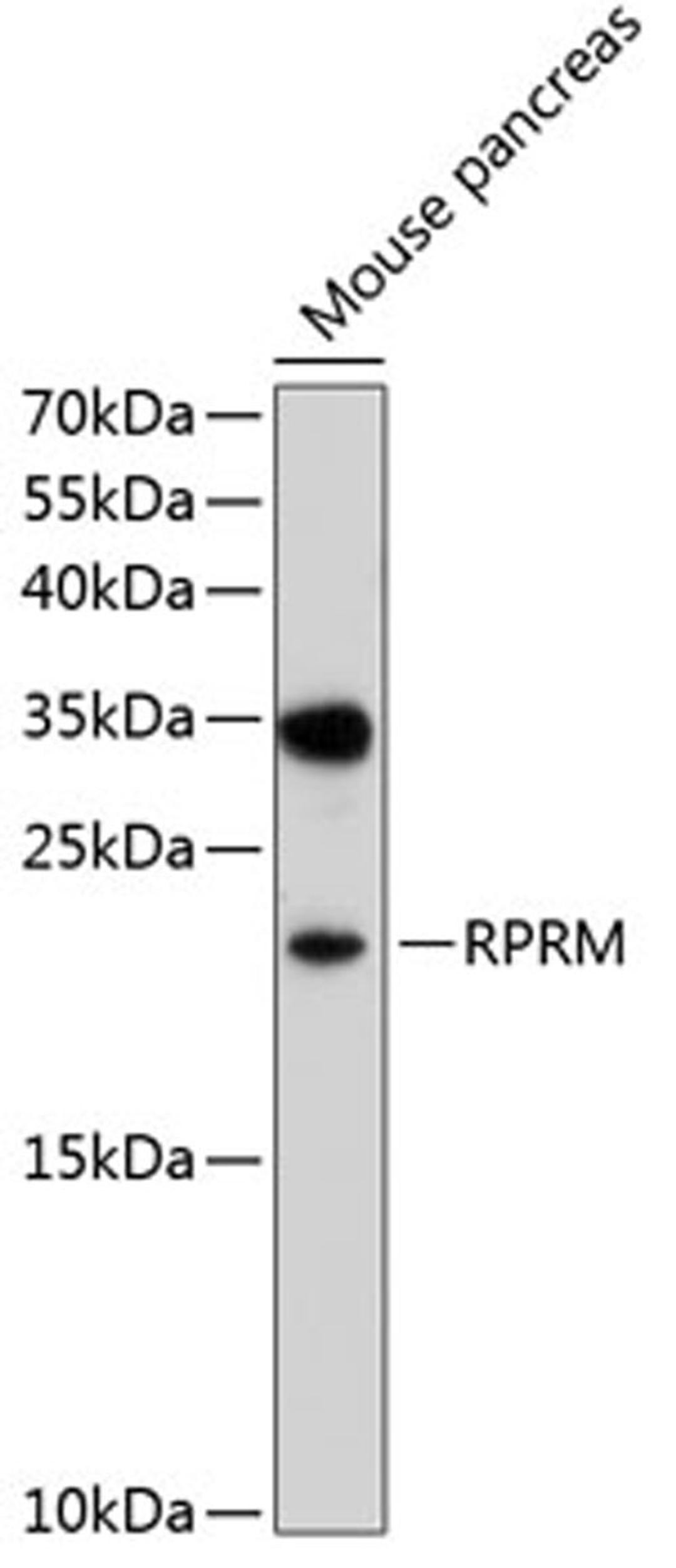 Western blot - RPRM antibody (A10013)