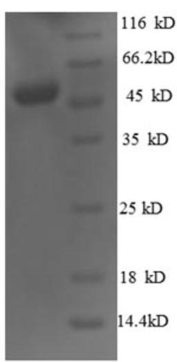 (Tris-Glycine gel) Discontinuous SDS-PAGE (reduced) with 5% enrichment gel and 15% separation gel.