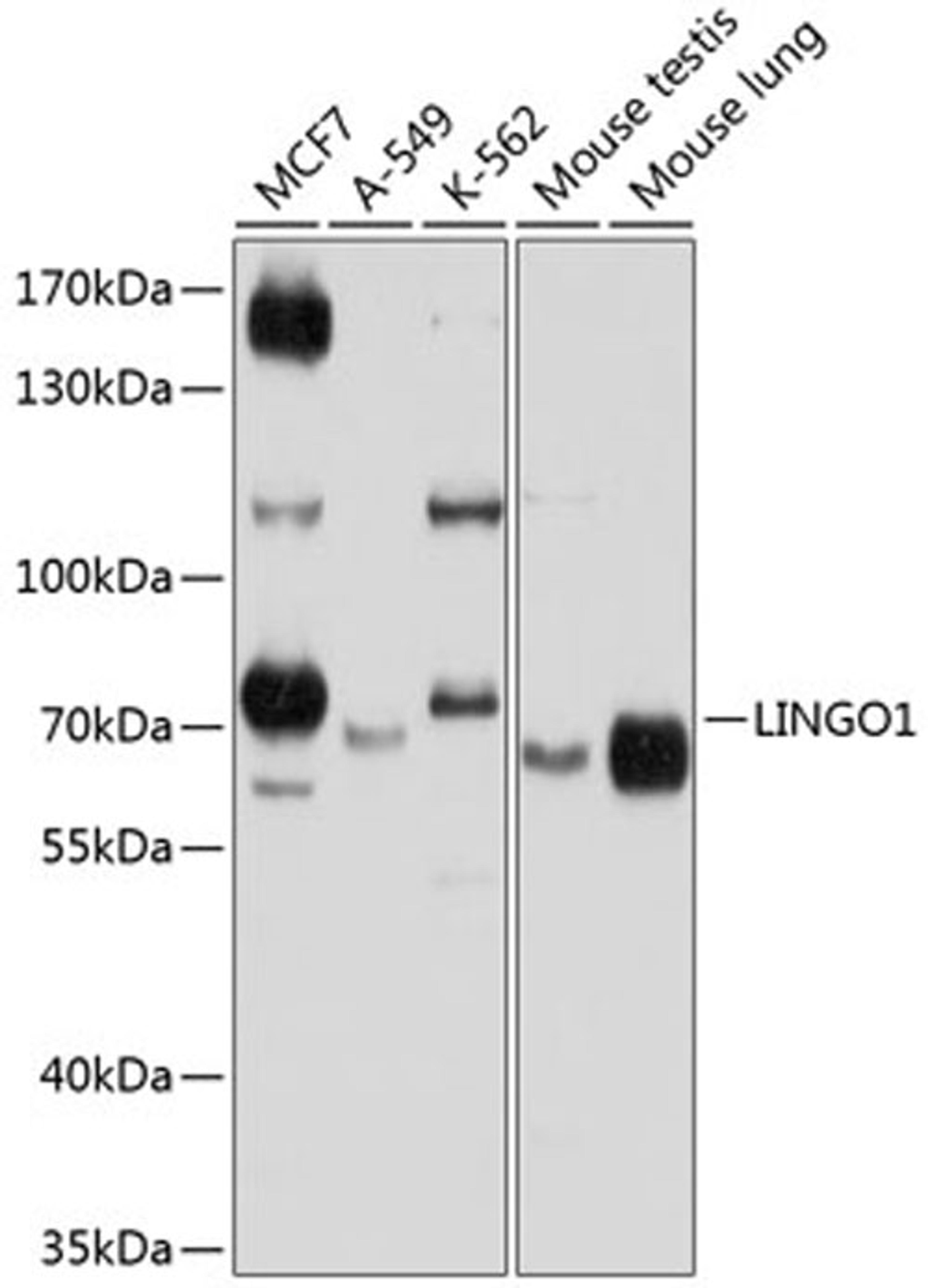 Western blot - LINGO1 antibody (A9369)