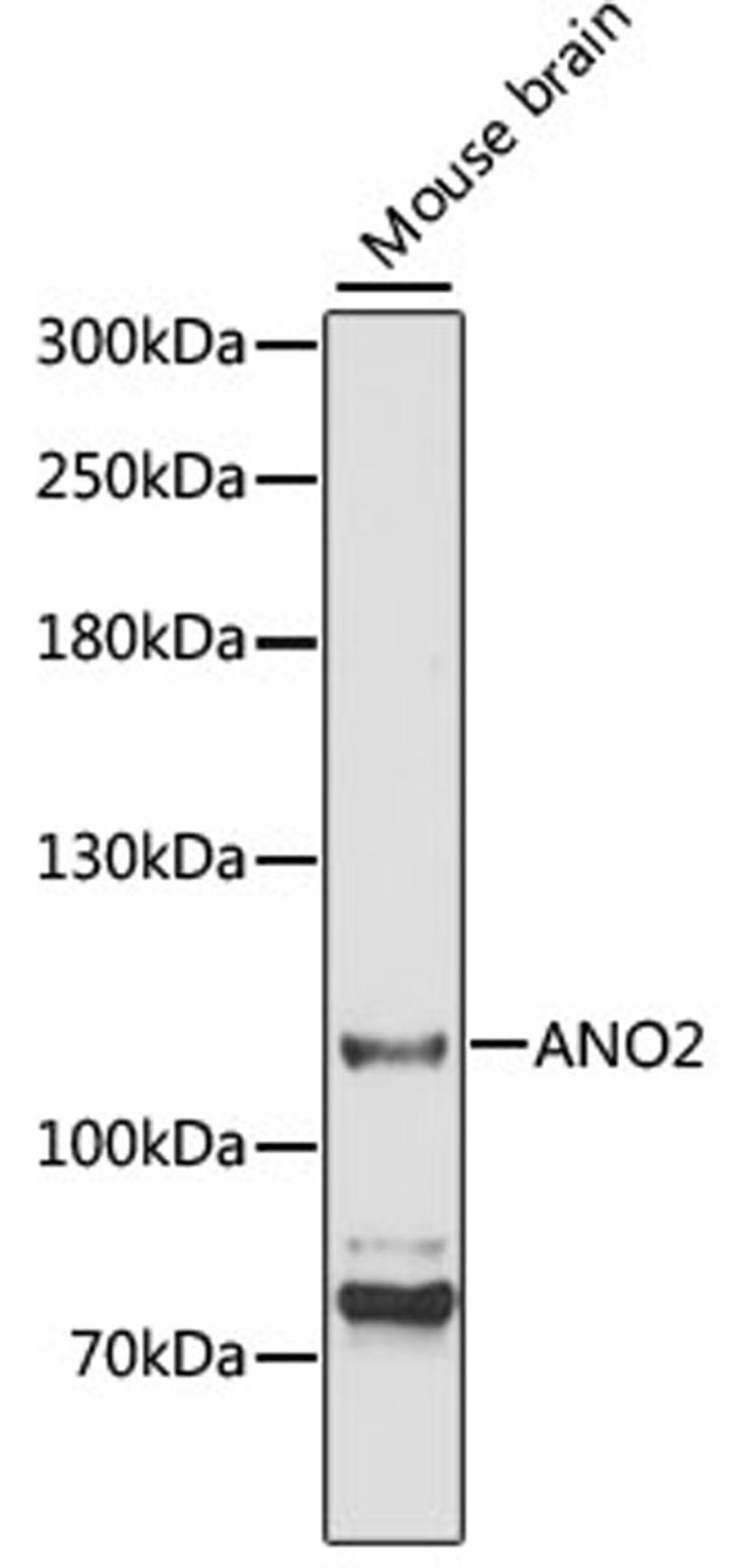 Western blot - ANO2 antibody (A3684)