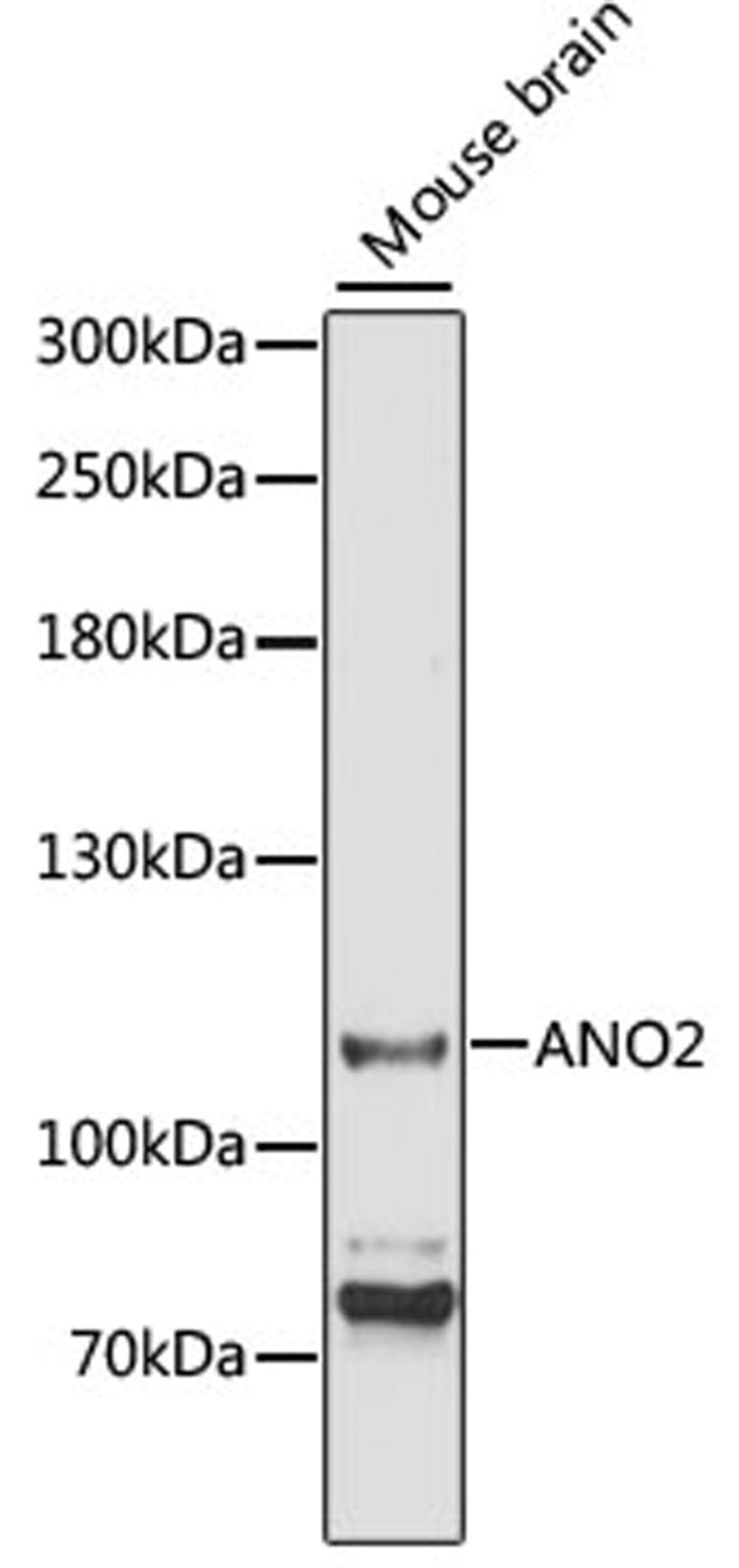 Western blot - ANO2 antibody (A3684)