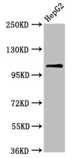 Western Blot. Positive WB detected in: HepG2 whole cell lysate. All lanes: USP4 antibody at 6.3µg/ml. Secondary. Goat polyclonal to rabbit IgG at 1/50000 dilution. Predicted band size: 109, 104, 36 kDa. Observed band size: 109 kDa