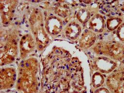 IHC image of CSB-PA619894LA01HU diluted at 1:400 and staining in paraffin-embedded human kidney tissue performed on a Leica BondTM system. After dewaxing and hydration, antigen retrieval was mediated by high pressure in a citrate buffer (pH 6.0). Section was blocked with 10% normal goat serum 30min at RT. Then primary antibody (1% BSA) was incubated at 4°C overnight. The primary is detected by a biotinylated secondary antibody and visualized using an HRP conjugated SP system.