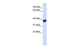 Antibody used in WB on Human Placenta at 0.2-1 ug/ml.