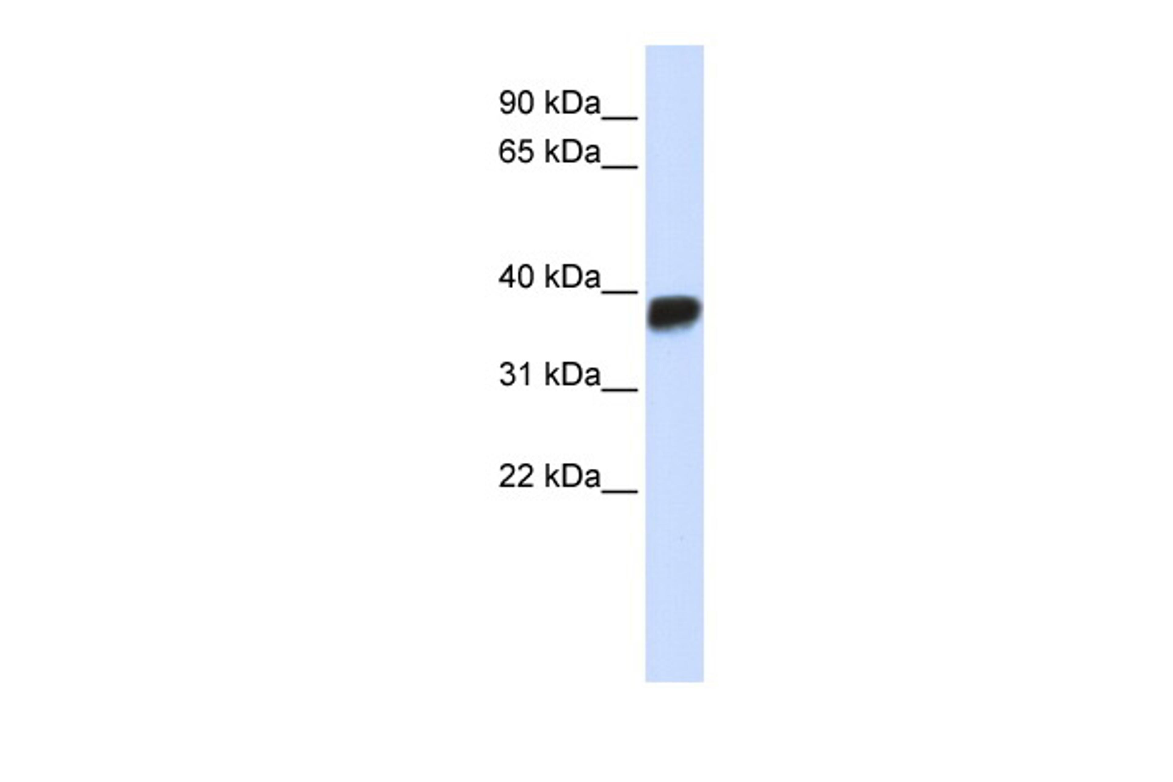 Antibody used in WB on Human Placenta at 0.2-1 ug/ml.