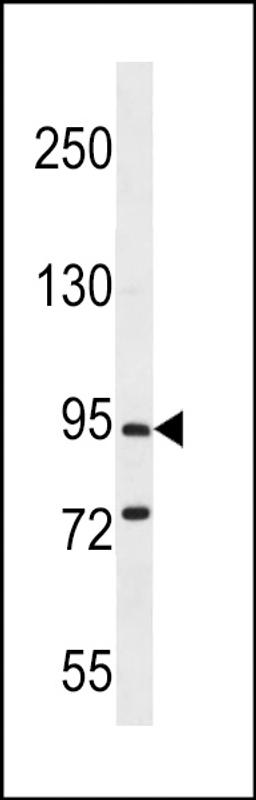 Western blot analysis in mouse brain tissue lysates (35ug/lane).