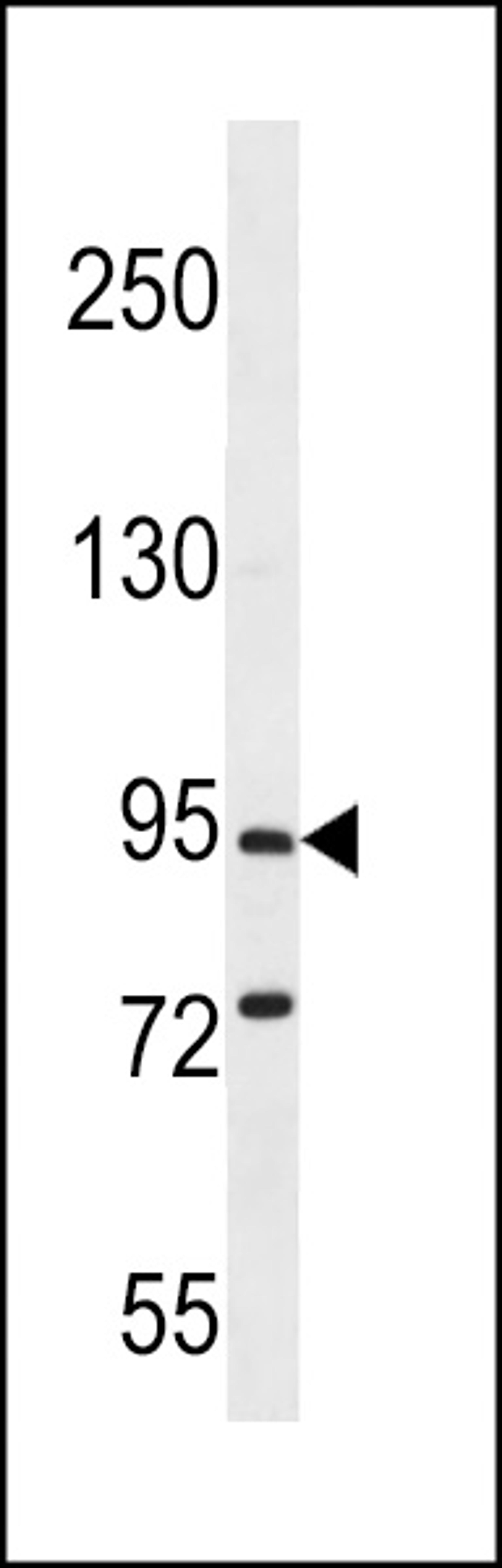 Western blot analysis in mouse brain tissue lysates (35ug/lane).