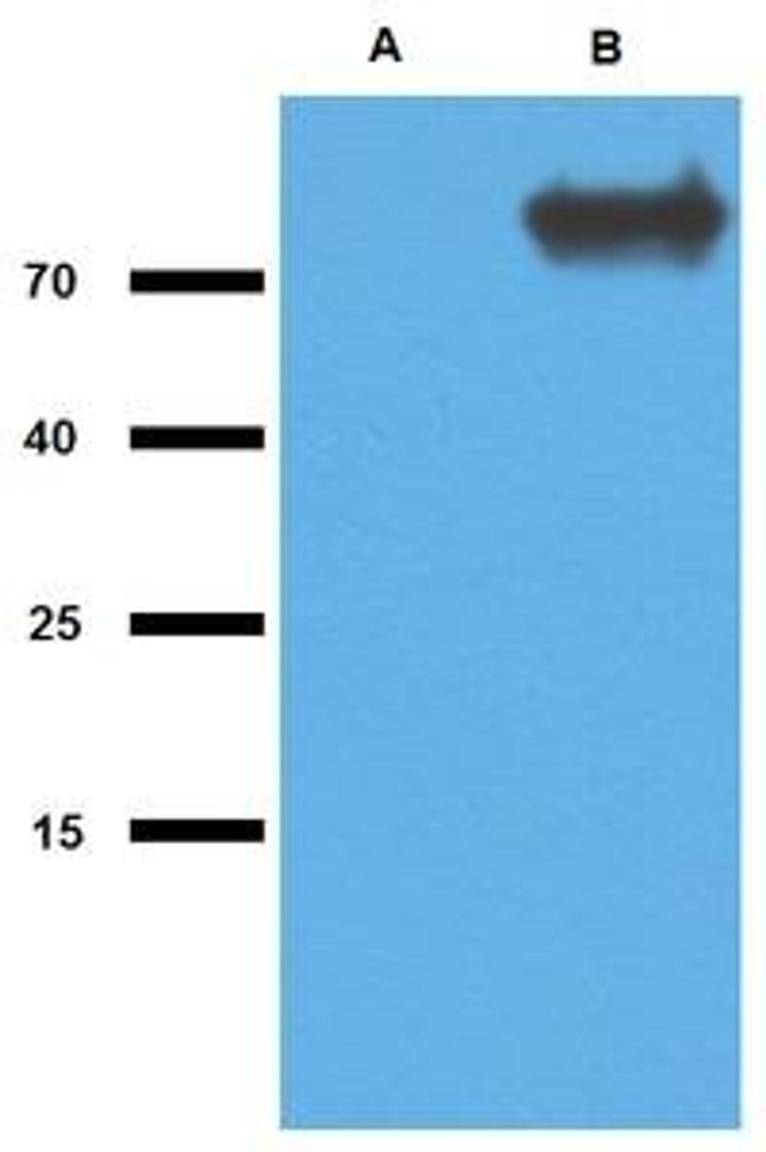 WB analysis of cell lysate of non-transfected E. Coli (Lane1), cell lysate of GlcB-transfected E. Coli (Lane2) using GlcB antibody