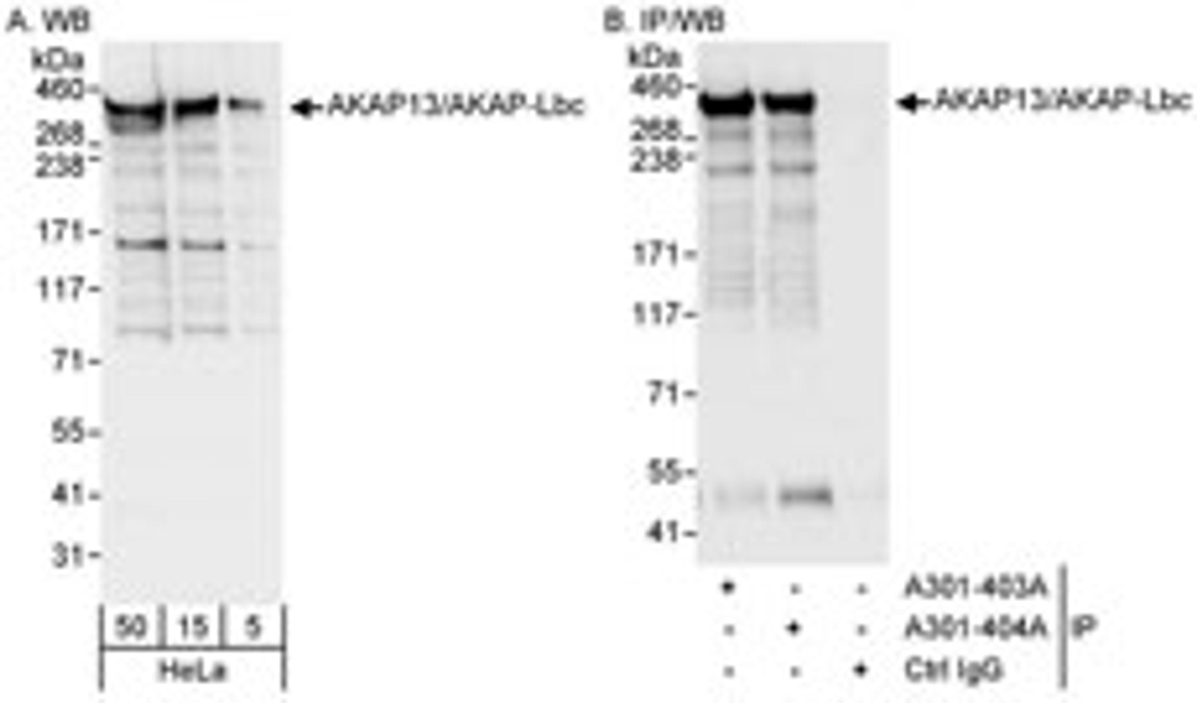 Detection of human AKAP13/AKAP-Lbc by western blot and immunoprecipitation.