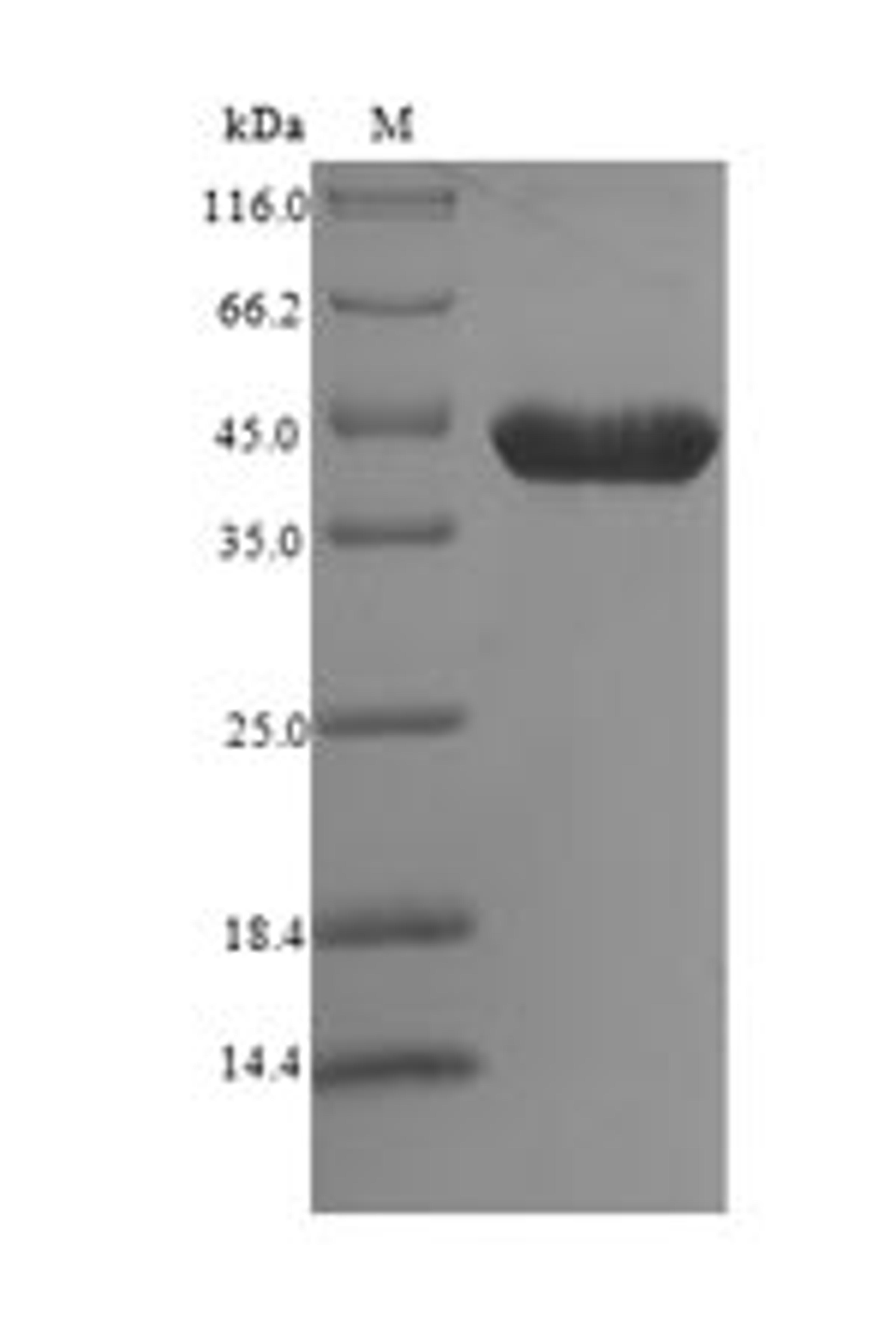 (Tris-Glycine gel) Discontinuous SDS-PAGE (reduced) with 5% enrichment gel and 15% separation gel.