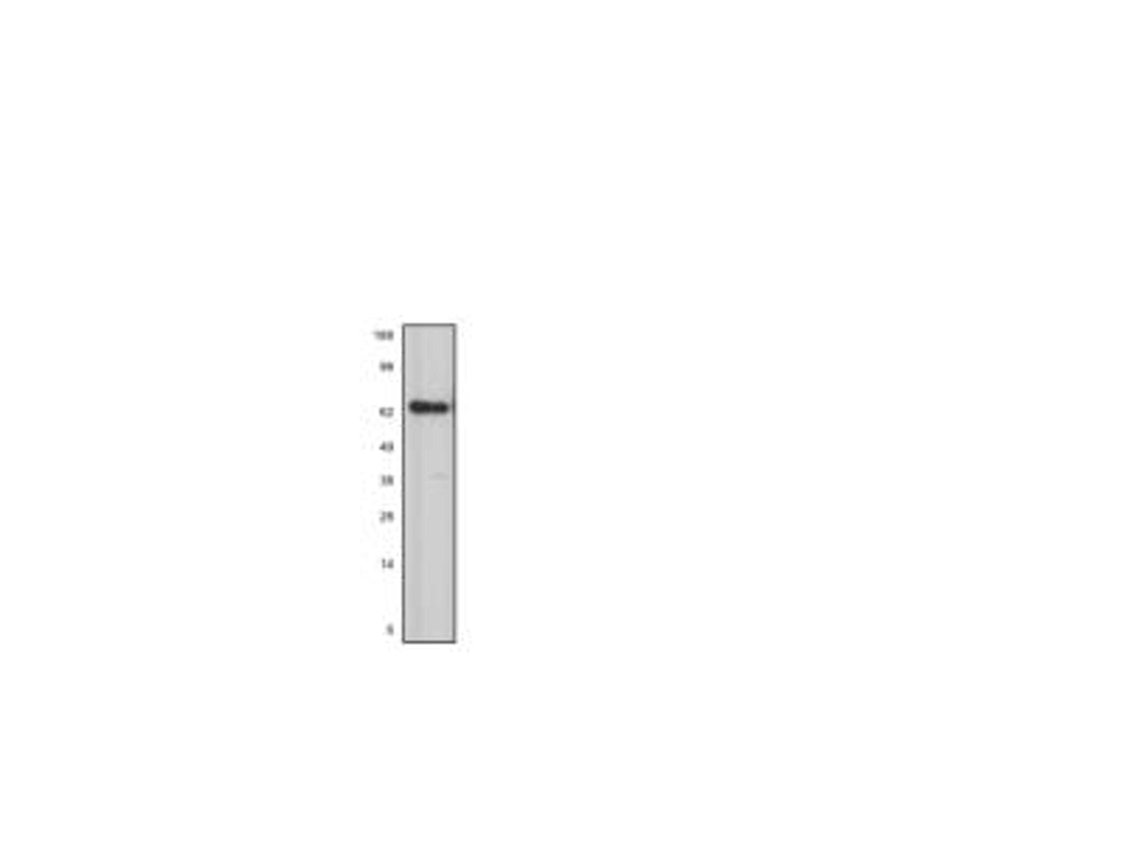 Western Blot: ZRANB1/Trabid Antibody [NBP1-01469] - Analysis of ZRANB1 in 293T whole cell lysate transfected with HA-Zranb1 plasmid using anti-ZRANB1 antibody. Image from verified customer review.