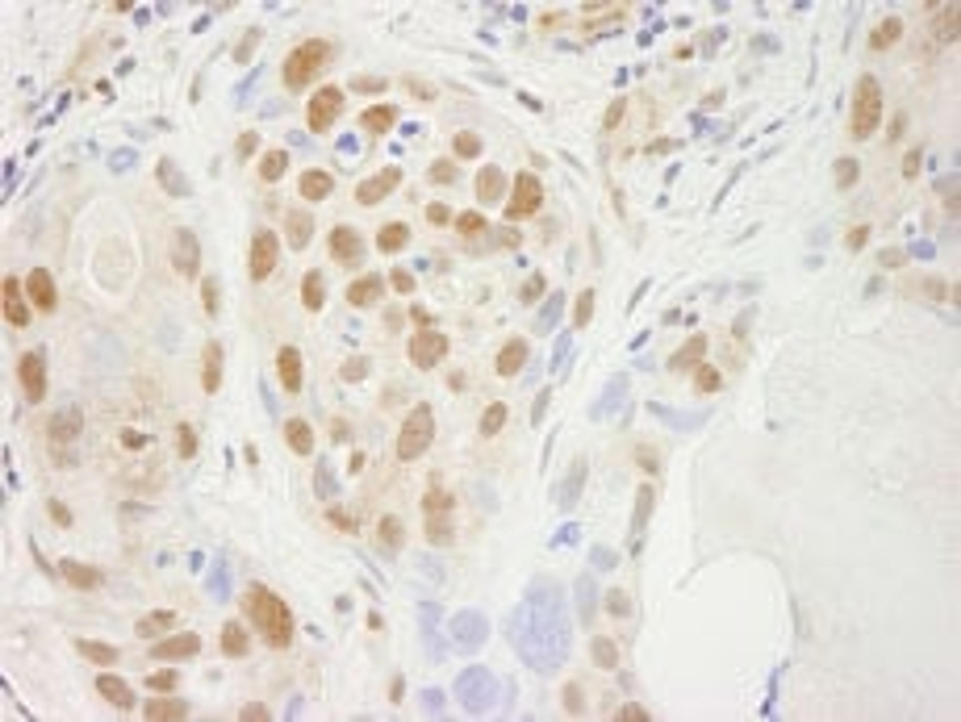 Detection of human SUPT5H by immunohistochemistry.