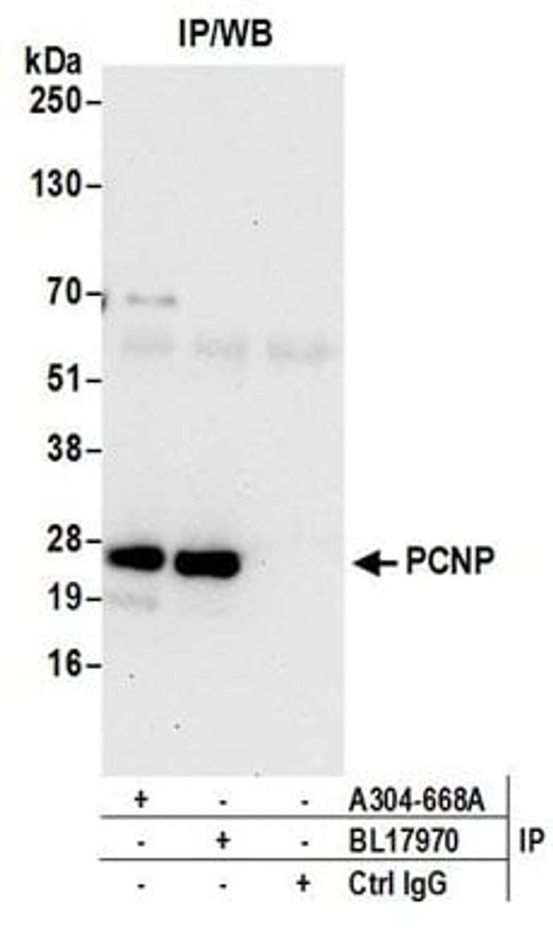 Detection of human PCNP by western blot of immunoprecipitates.