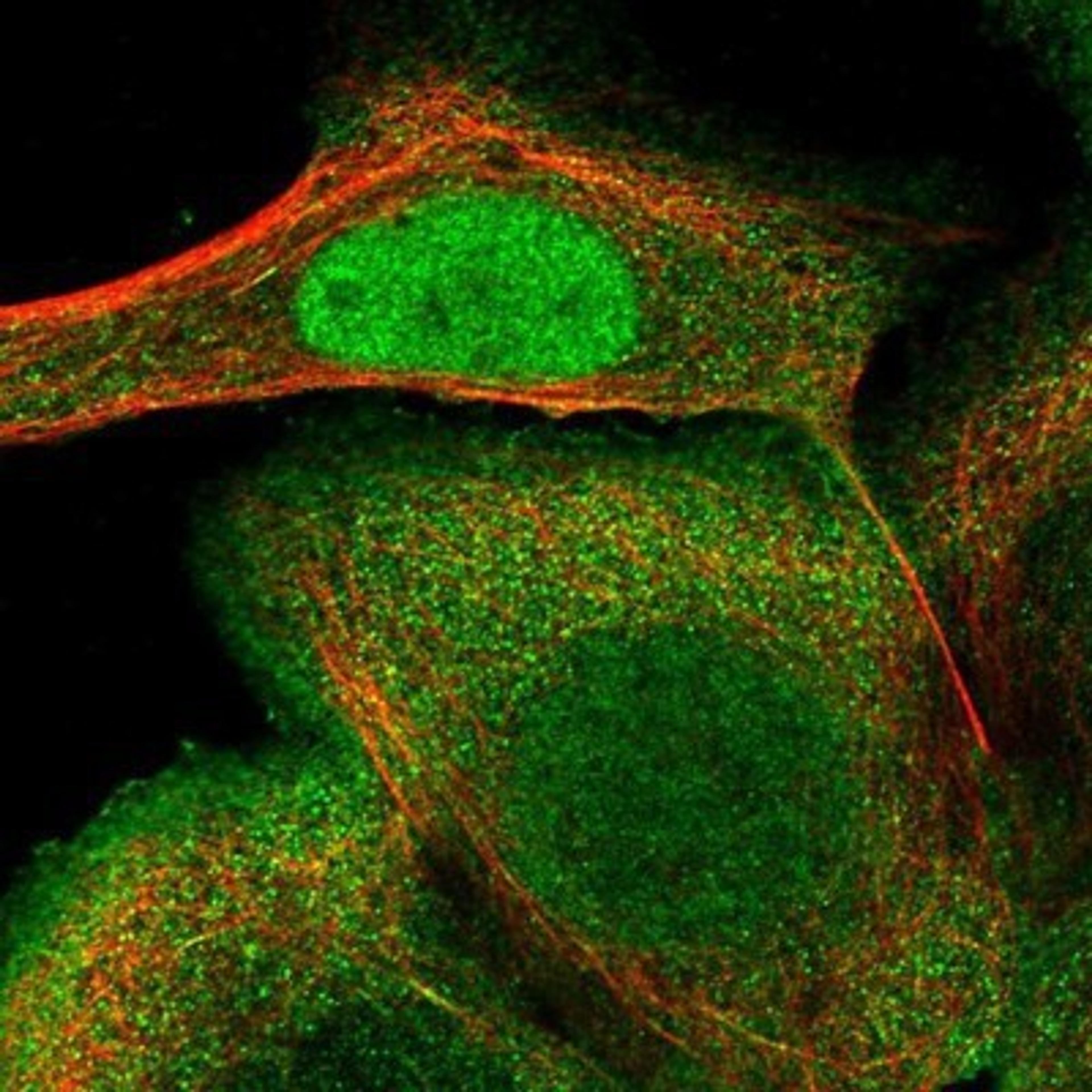 Immunocytochemistry/Immunofluorescence: PRC1 Antibody [NBP1-88856] - Staining of human cell line A-431 shows positivity in nucleus but not nucleoli, plasma membrane & cytoskeleton (microtubules).