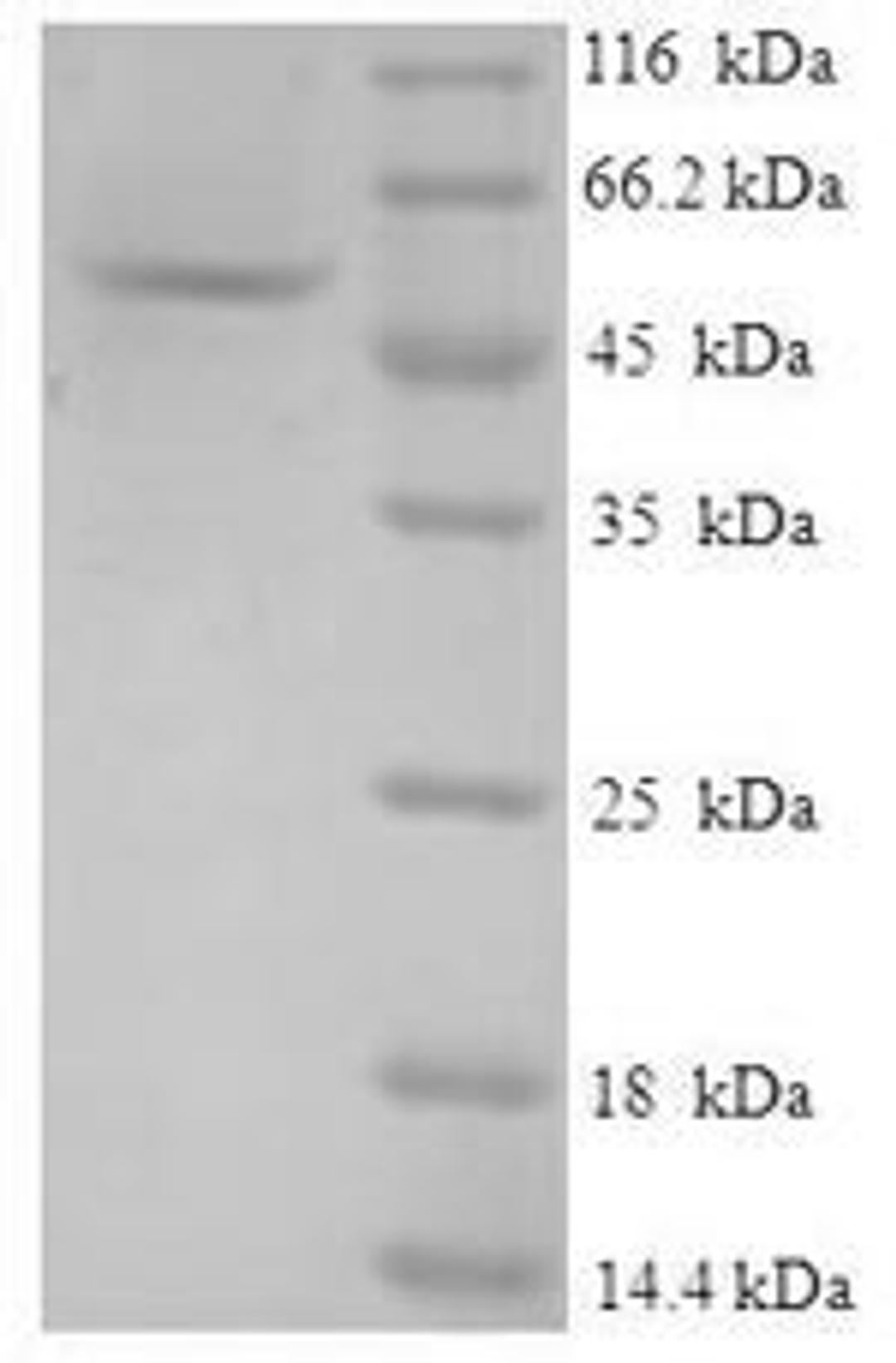 (Tris-Glycine gel) Discontinuous SDS-PAGE (reduced) with 5% enrichment gel and 15% separation gel.