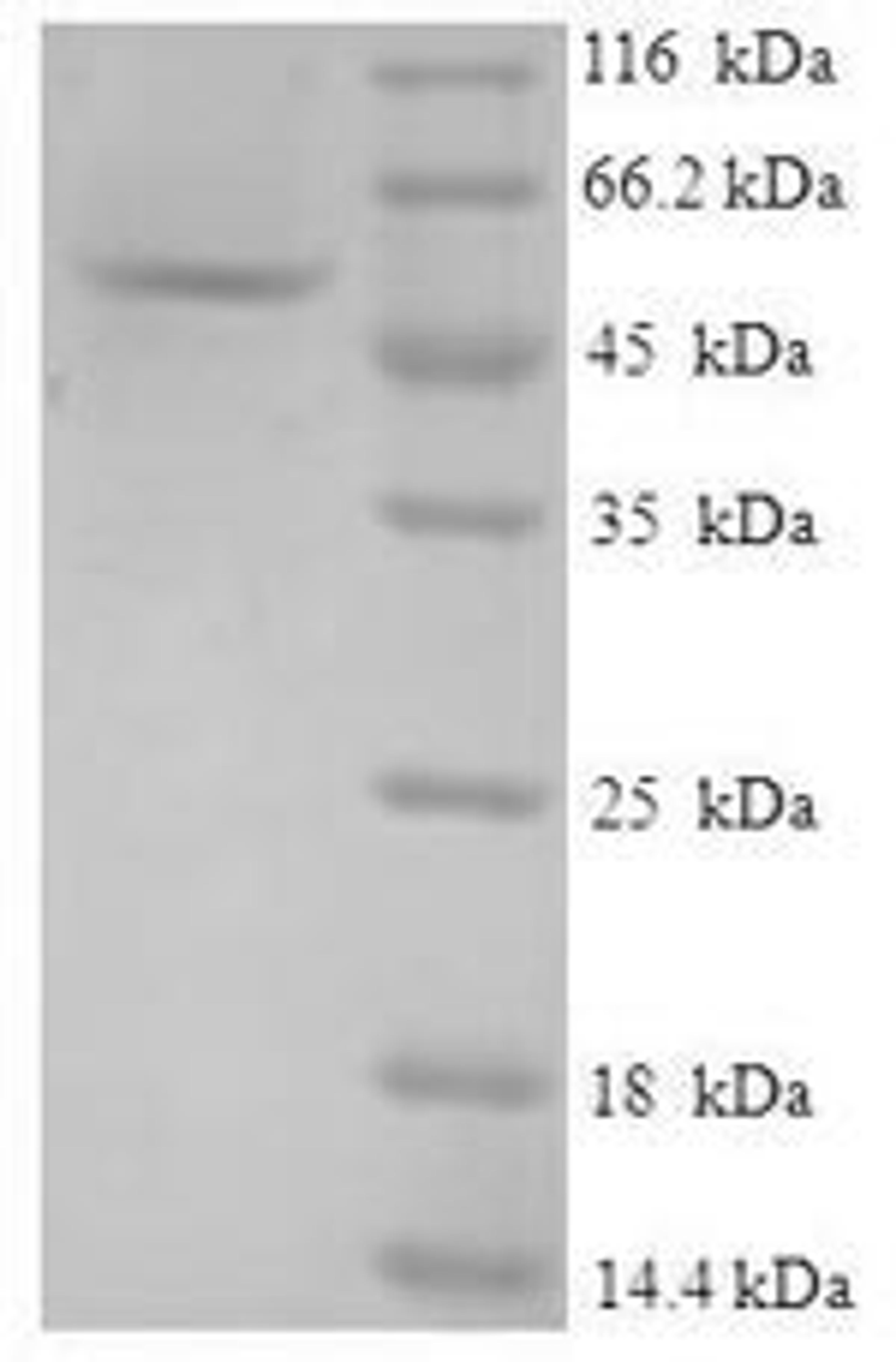 (Tris-Glycine gel) Discontinuous SDS-PAGE (reduced) with 5% enrichment gel and 15% separation gel.