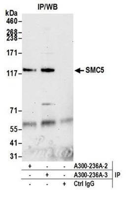 Detection of human SMC5 by western blot of immunoprecipitates.