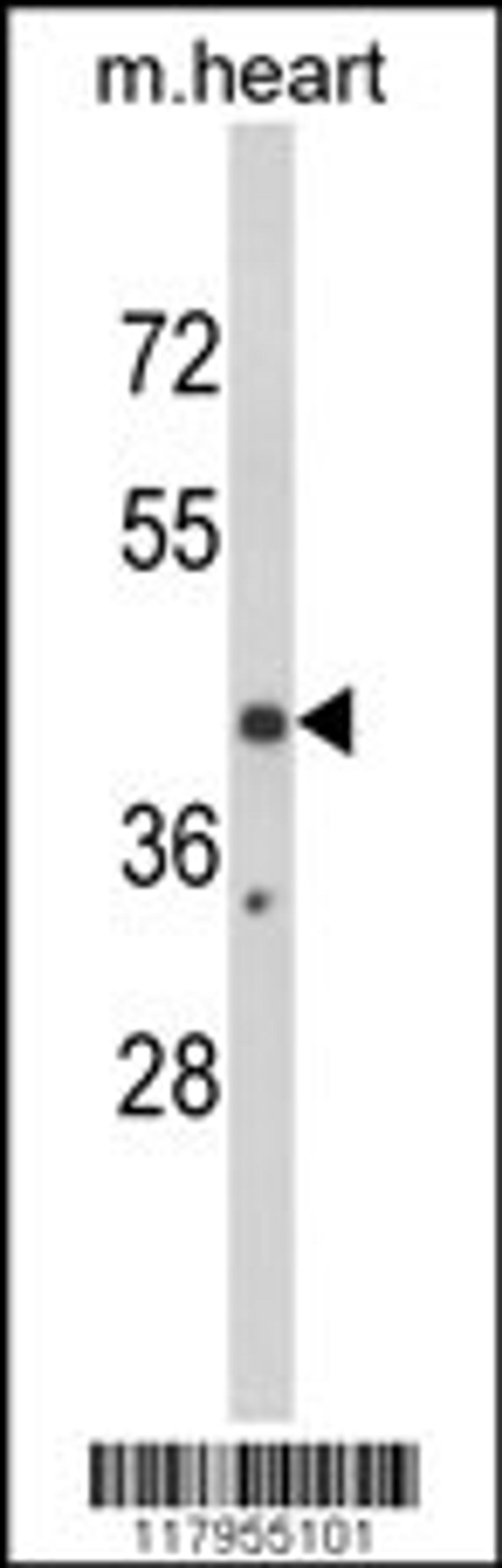 Western blot analysis of EGR3 Antibody in mouse heart tissue lysates (35ug/lane)