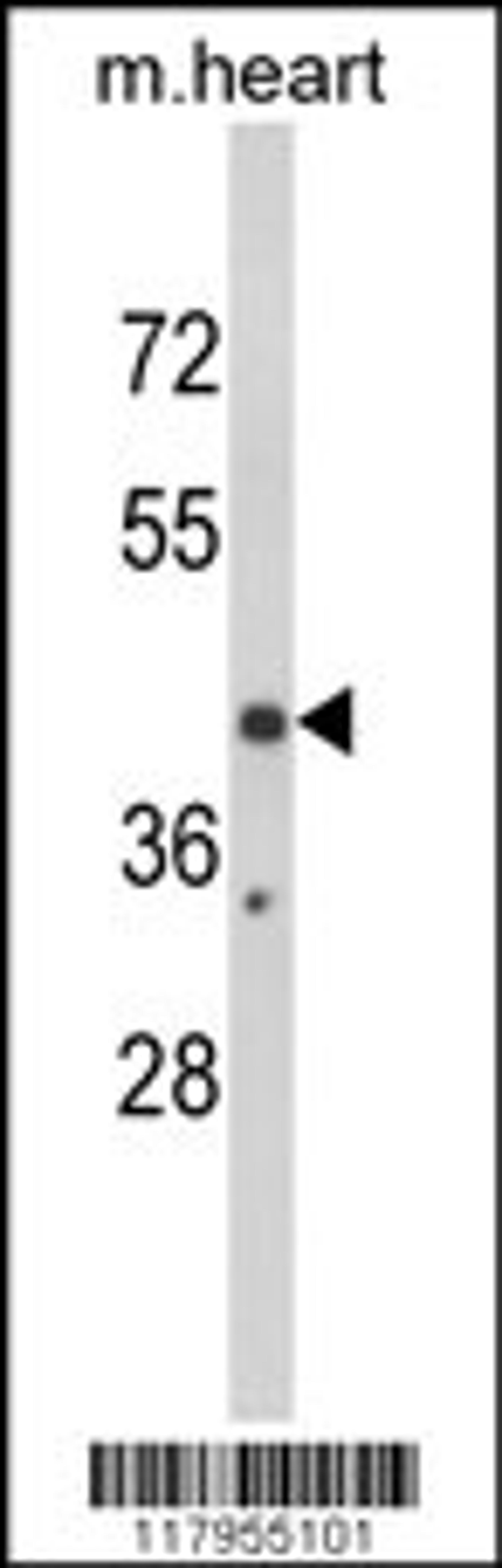 Western blot analysis of EGR3 Antibody in mouse heart tissue lysates (35ug/lane)