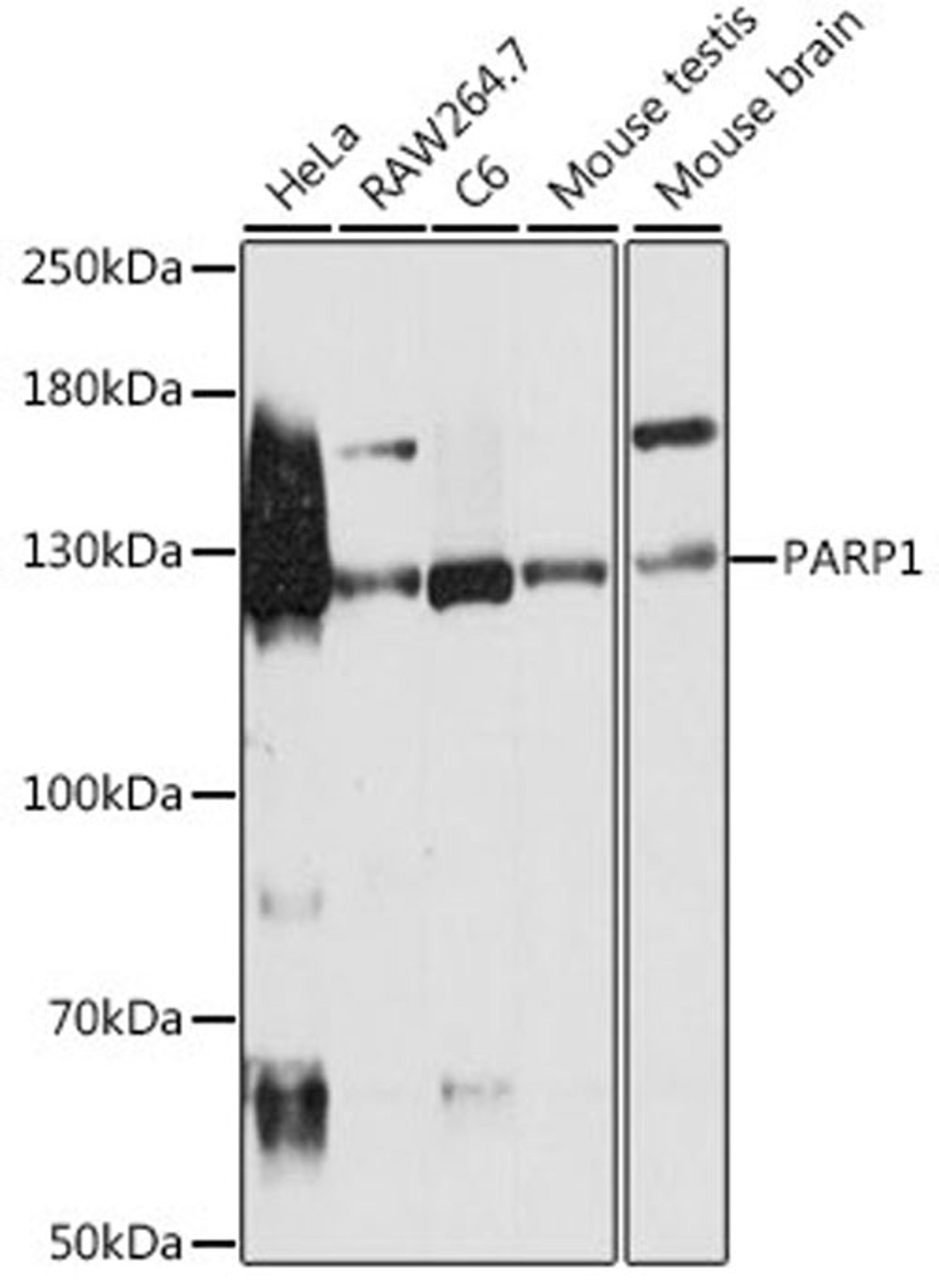 Western blot - PARP1 antibody (A0942)