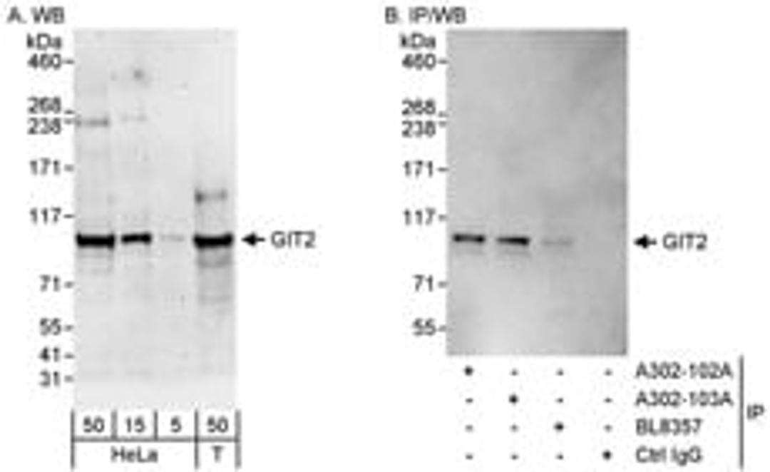 Detection of human GIT2 by western blot and immunoprecipitation.