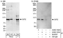 Detection of human GIT2 by western blot and immunoprecipitation.