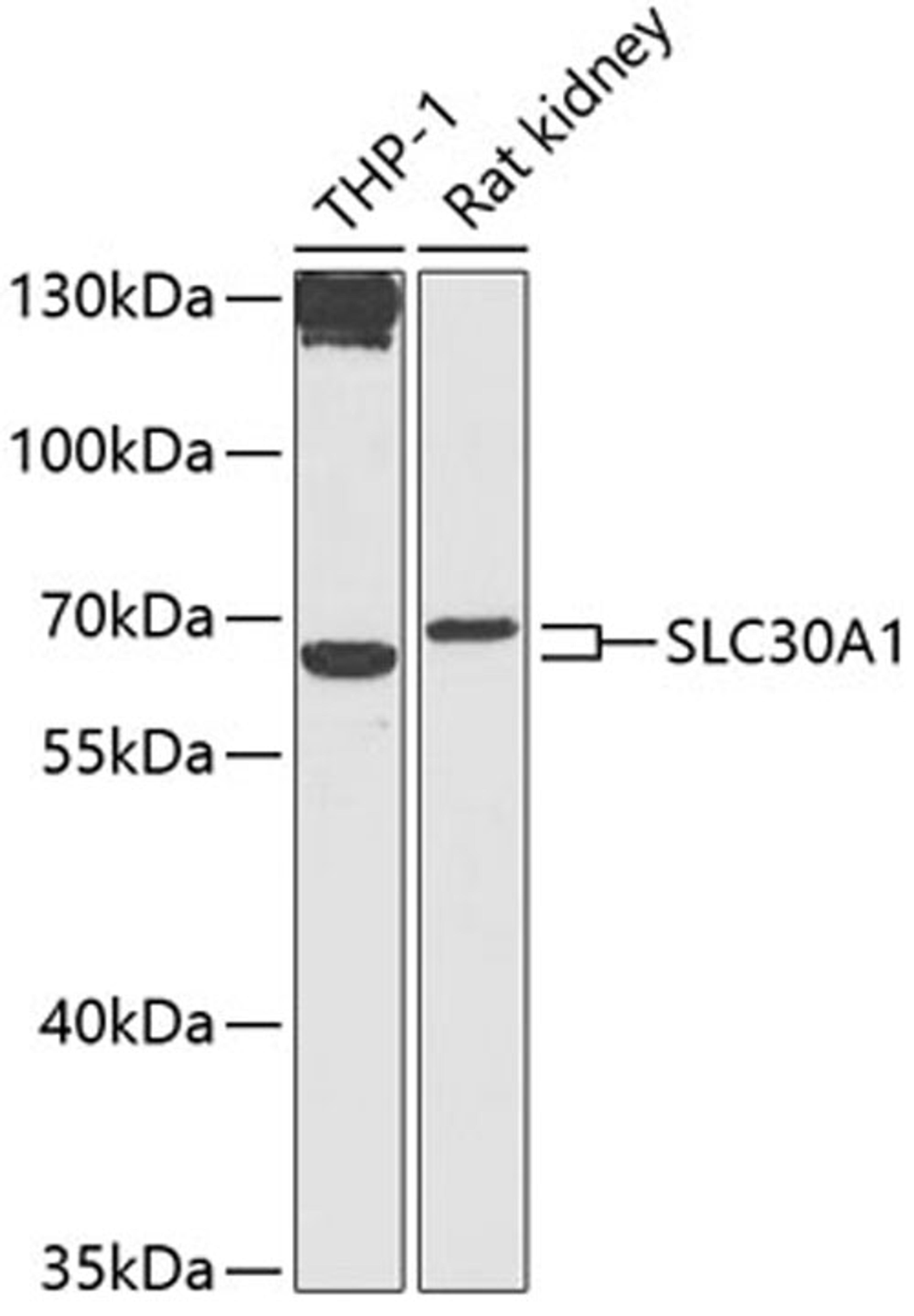 Western blot - SLC30A1 antibody (A12532)