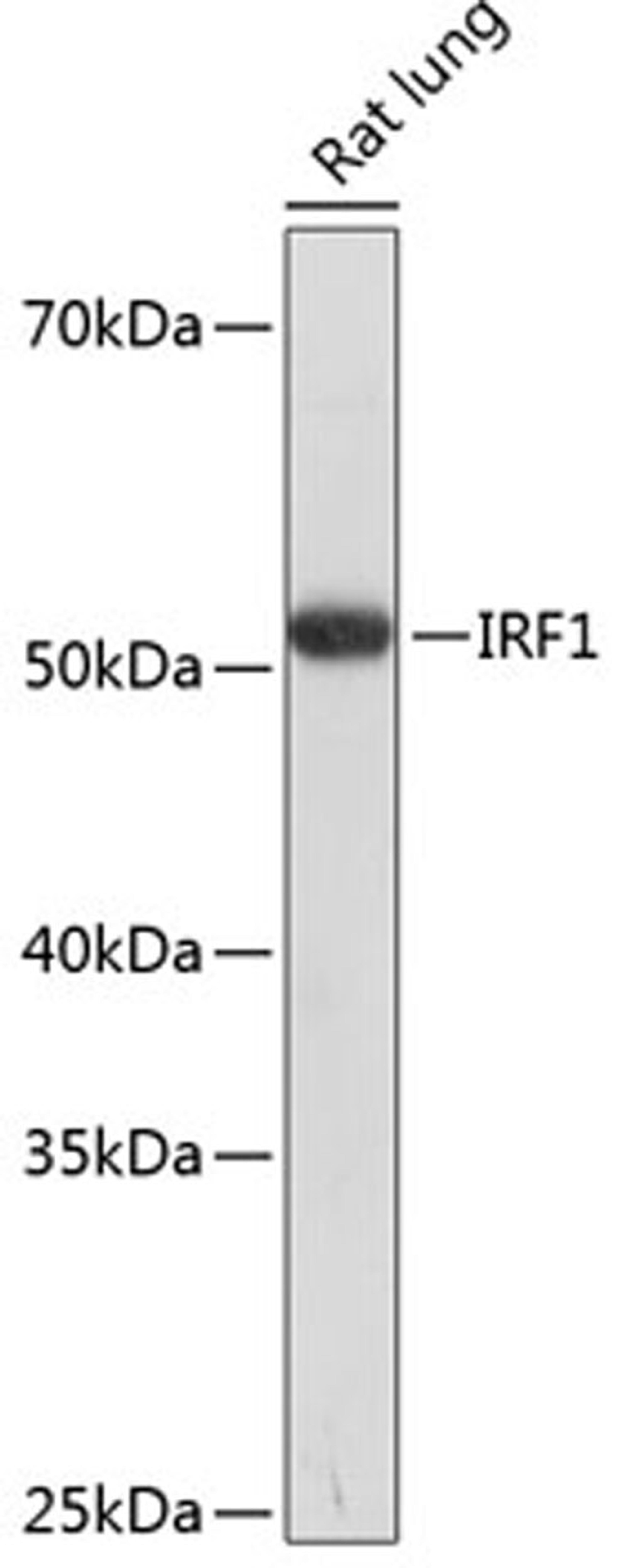 Western blot - IRF1 Polyclonal Antibody (A7692)