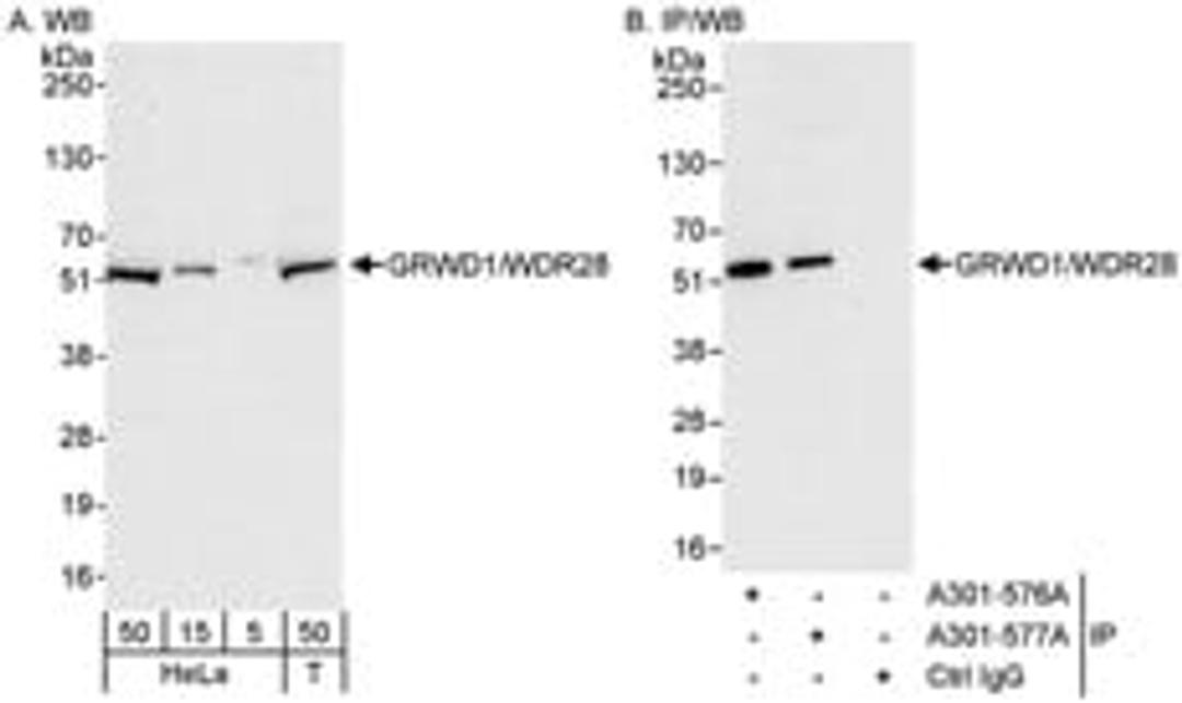 Detection of human GRWD1/WDR28 by western blot and immunoprecipitation.