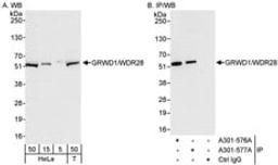 Detection of human GRWD1/WDR28 by western blot and immunoprecipitation.