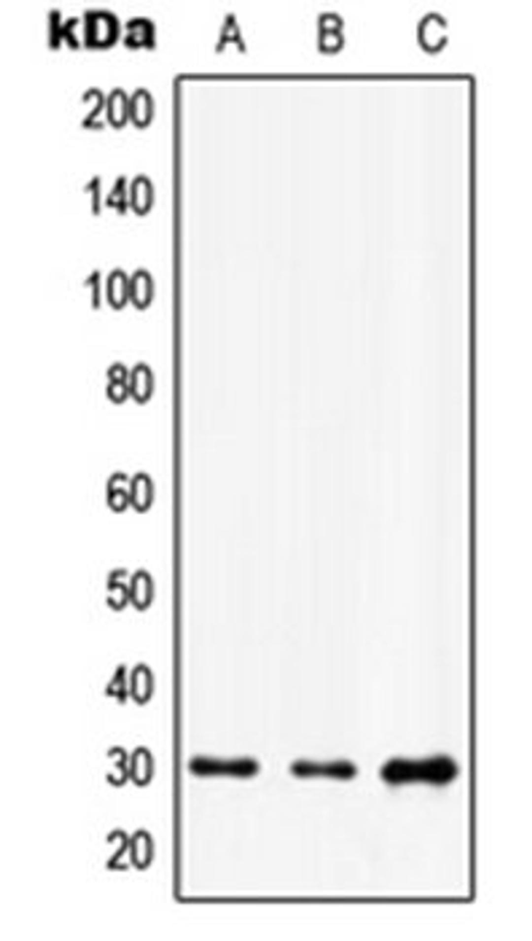 Western blot analysis of A549 (Lane 1), HuvEc (Lane 2), NIH3T3 (Lane 3) whole cell lysates using HOXD12 antibody