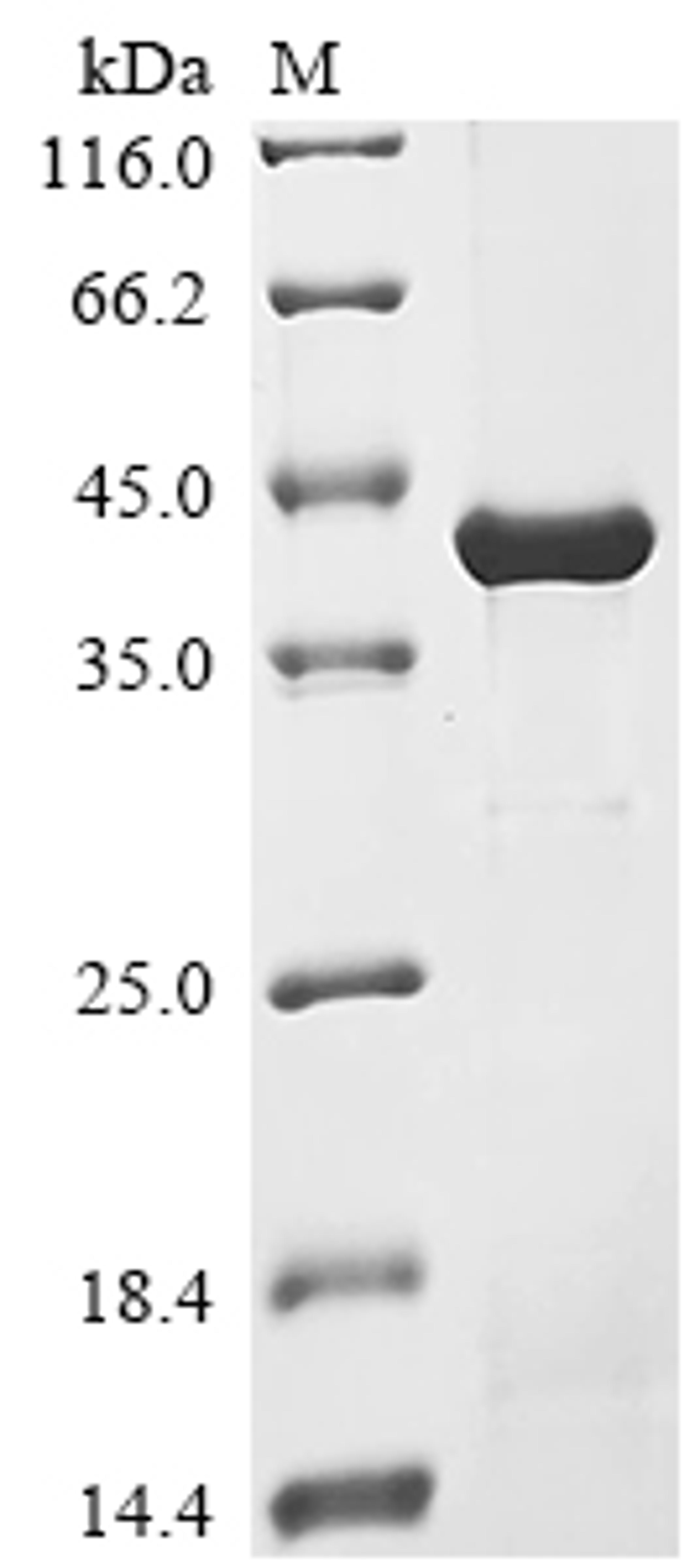 (Tris-Glycine gel) Discontinuous SDS-PAGE (reduced) with 5% enrichment gel and 15% separation gel.