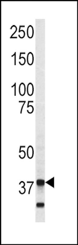 Western blot analysis of Annexin V antibody in SK-Br-3 cell line lysates (35ug/lane)