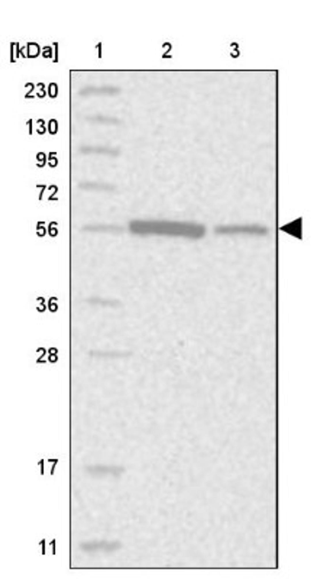 Western Blot: ALDH5A1 Antibody [NBP1-86996] - Lane 1: Marker [kDa] 230, 130, 95, 72, 56, 36, 28, 17, 11<br/>Lane 2: Human cell line RT-4<br/>Lane 3: Human cell line U-251MG sp