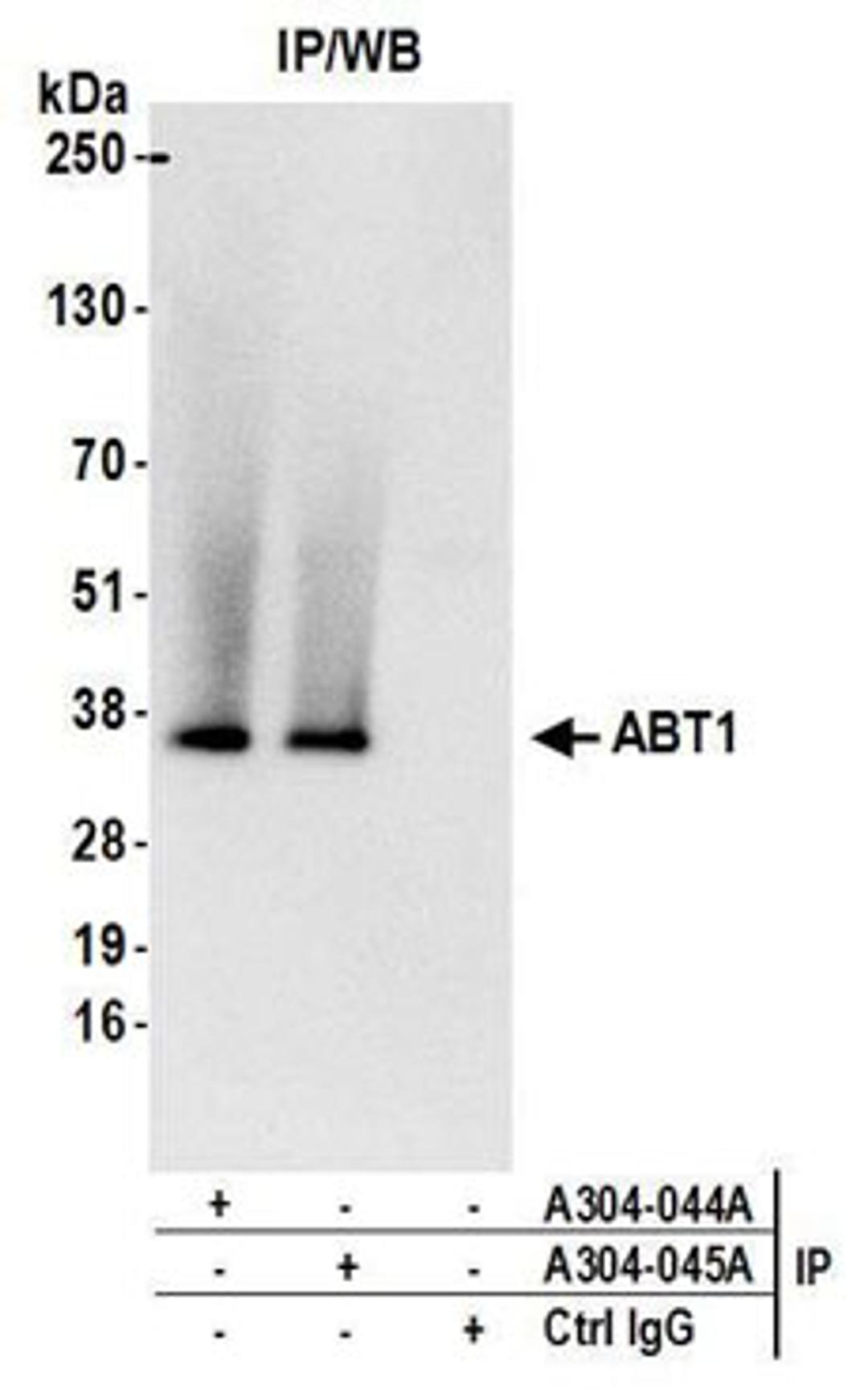 Detection of human ABT1 by western blot of immunoprecipitates.