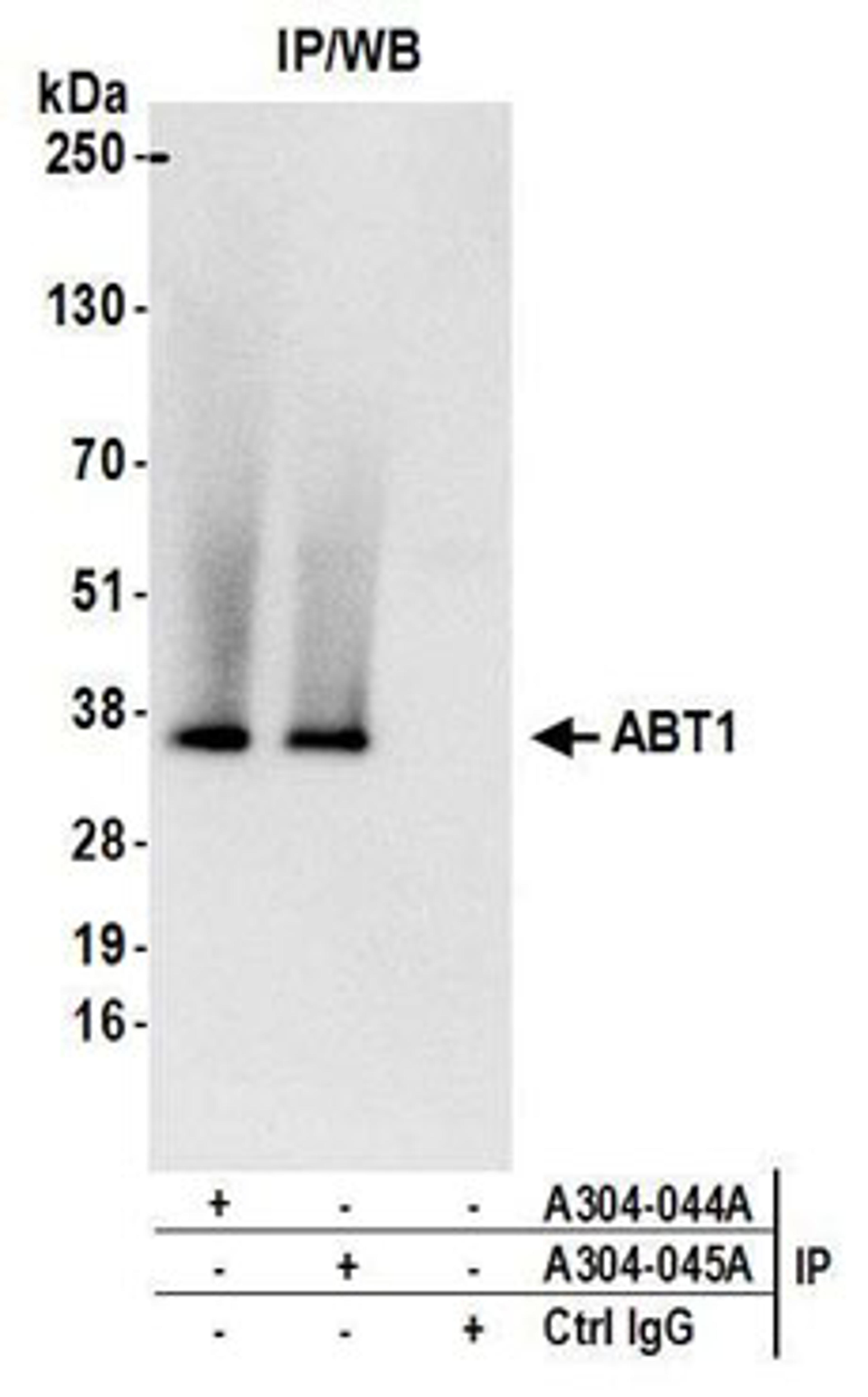 Detection of human ABT1 by western blot of immunoprecipitates.