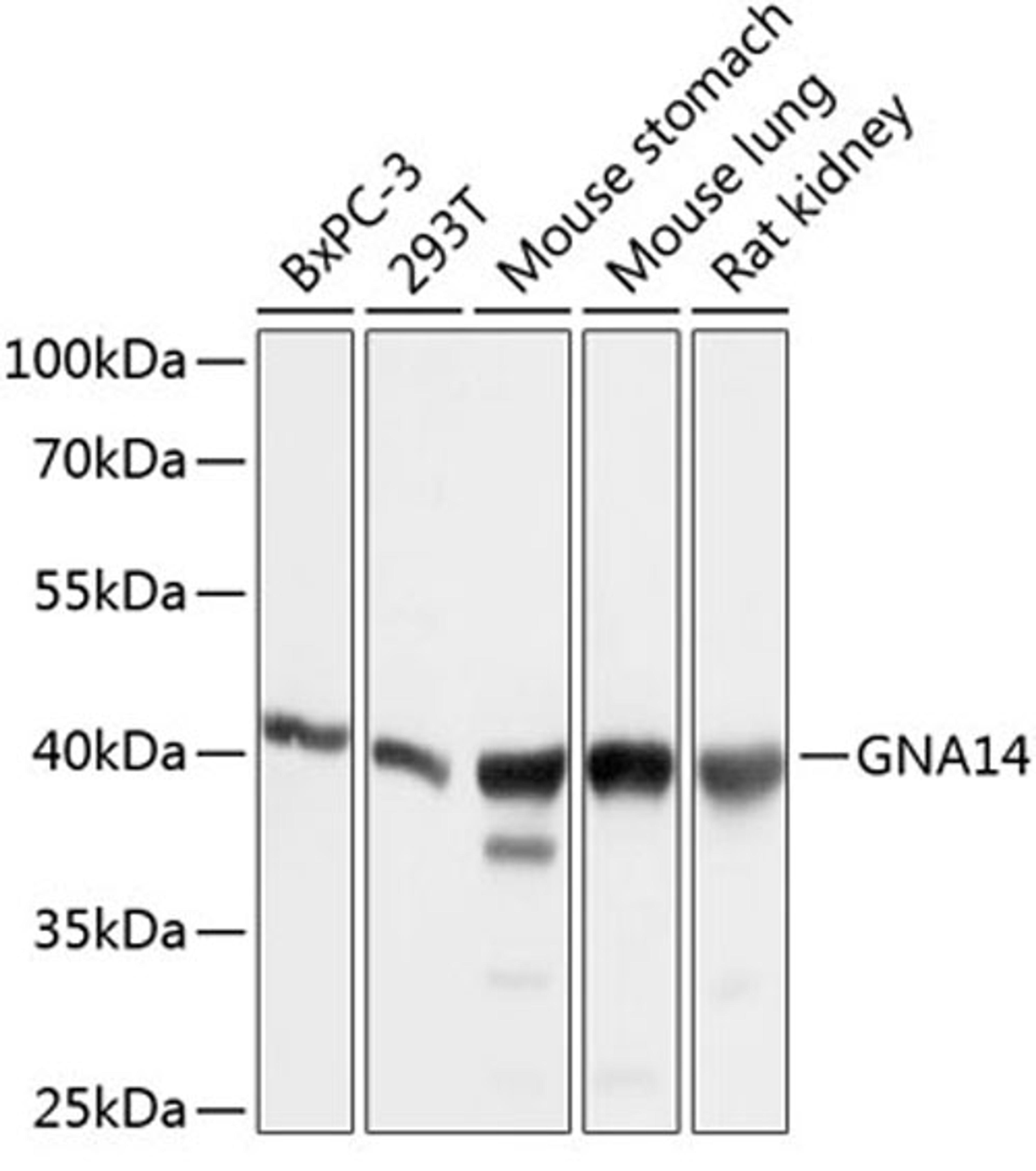 Western blot - GNA14 antibody (A10405)