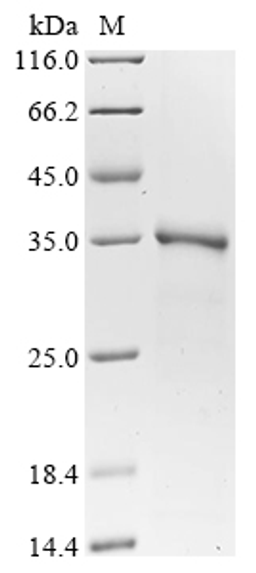 (Tris-Glycine gel) Discontinuous SDS-PAGE (reduced) with 5% enrichment gel and 15% separation gel.