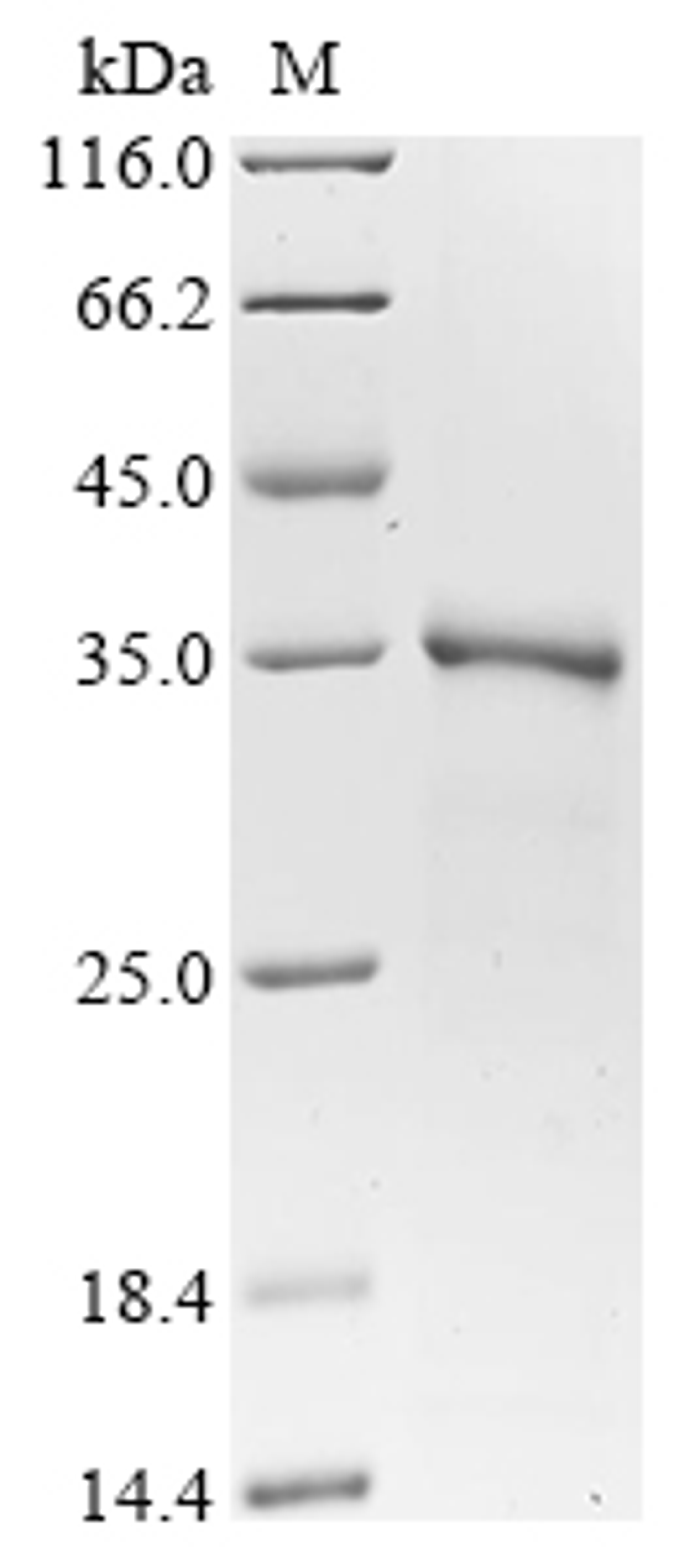 (Tris-Glycine gel) Discontinuous SDS-PAGE (reduced) with 5% enrichment gel and 15% separation gel.