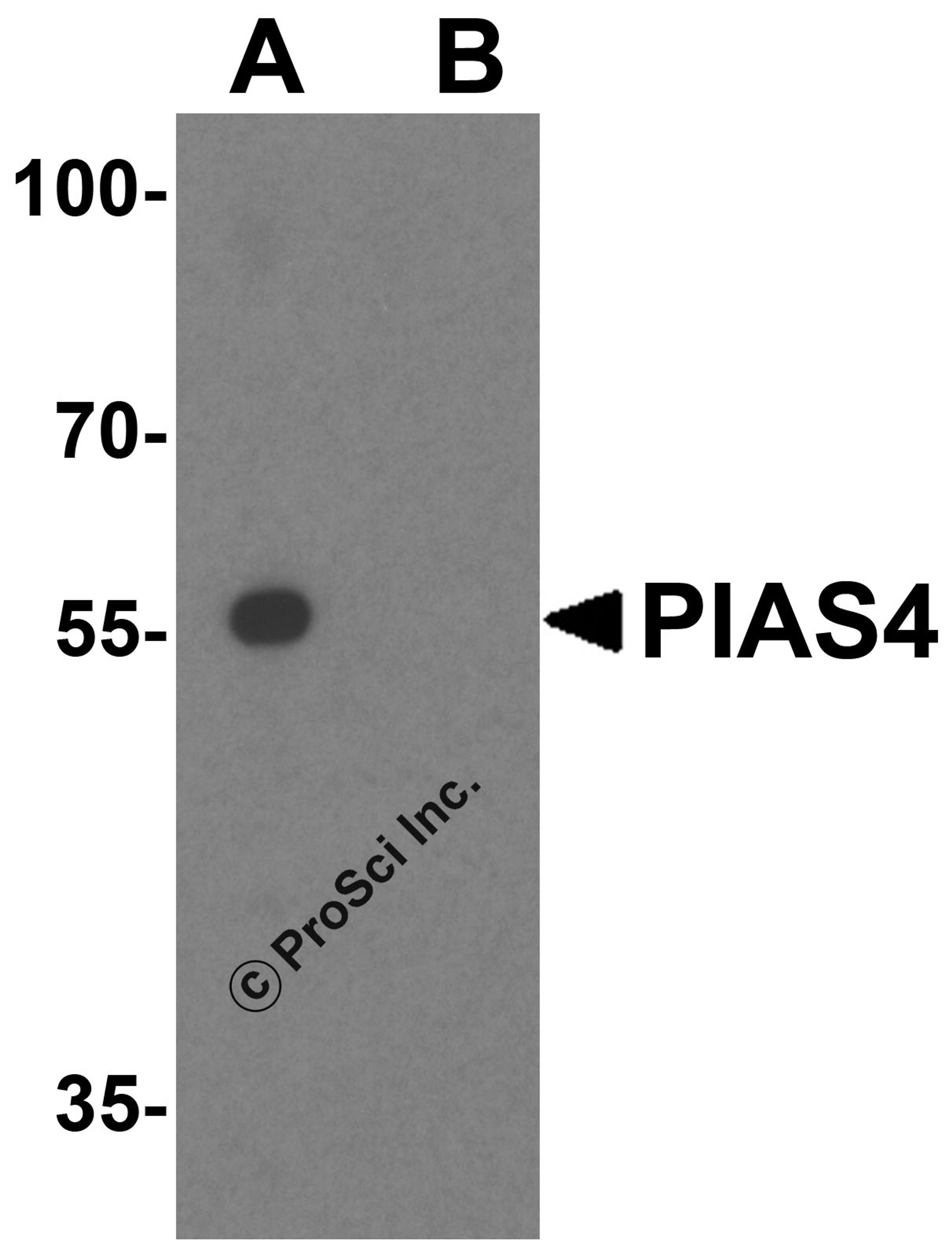 Western blot analysis of PIAS4 in HL60 cell lysate with PIAS4 antibody at 1 μg/mL in (A) the absence and (B) the presence of blocking peptide.