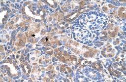 Antibody used in IHC on Human kidney.