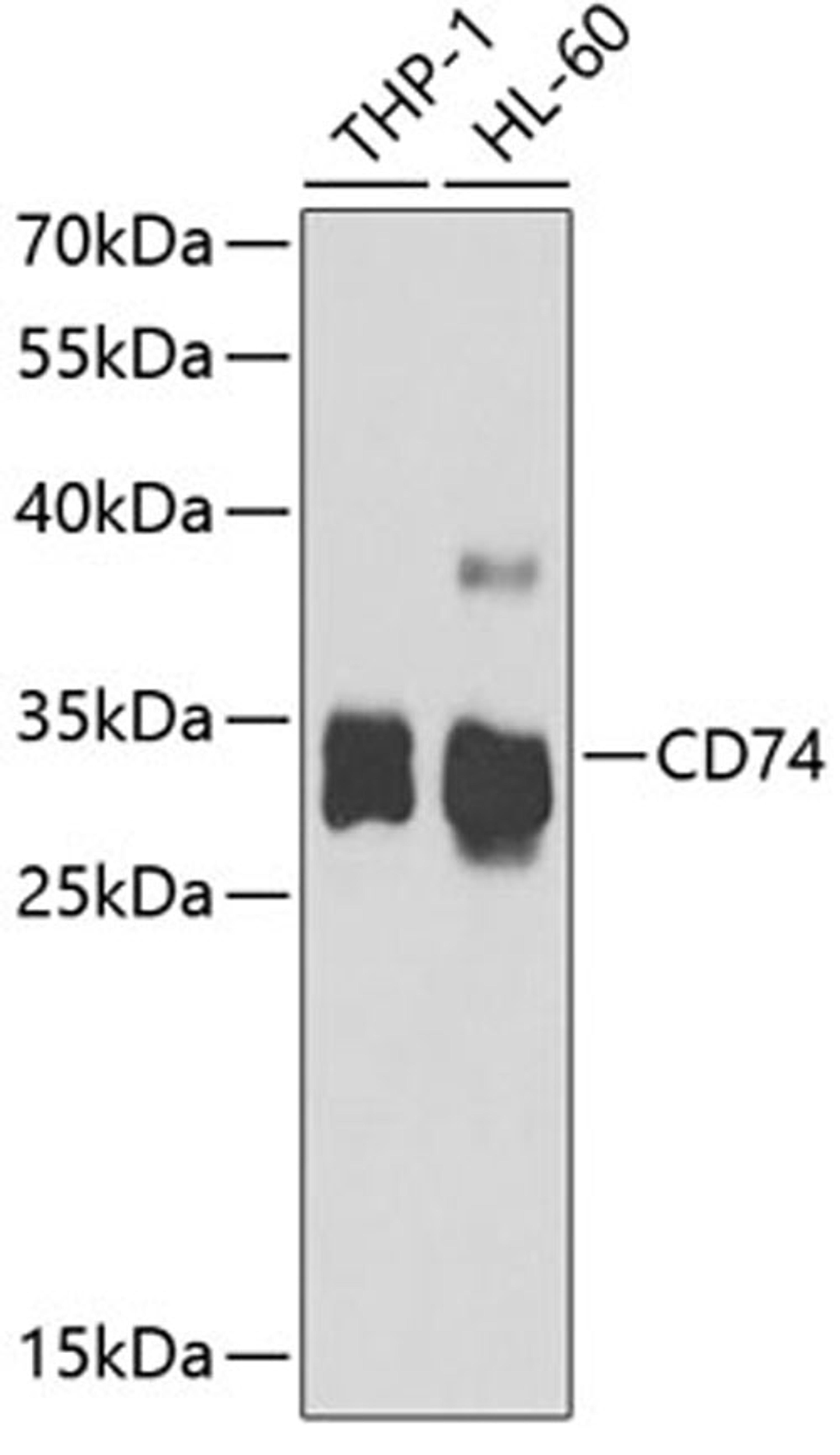 Western blot - CD74 antibody (A5667)