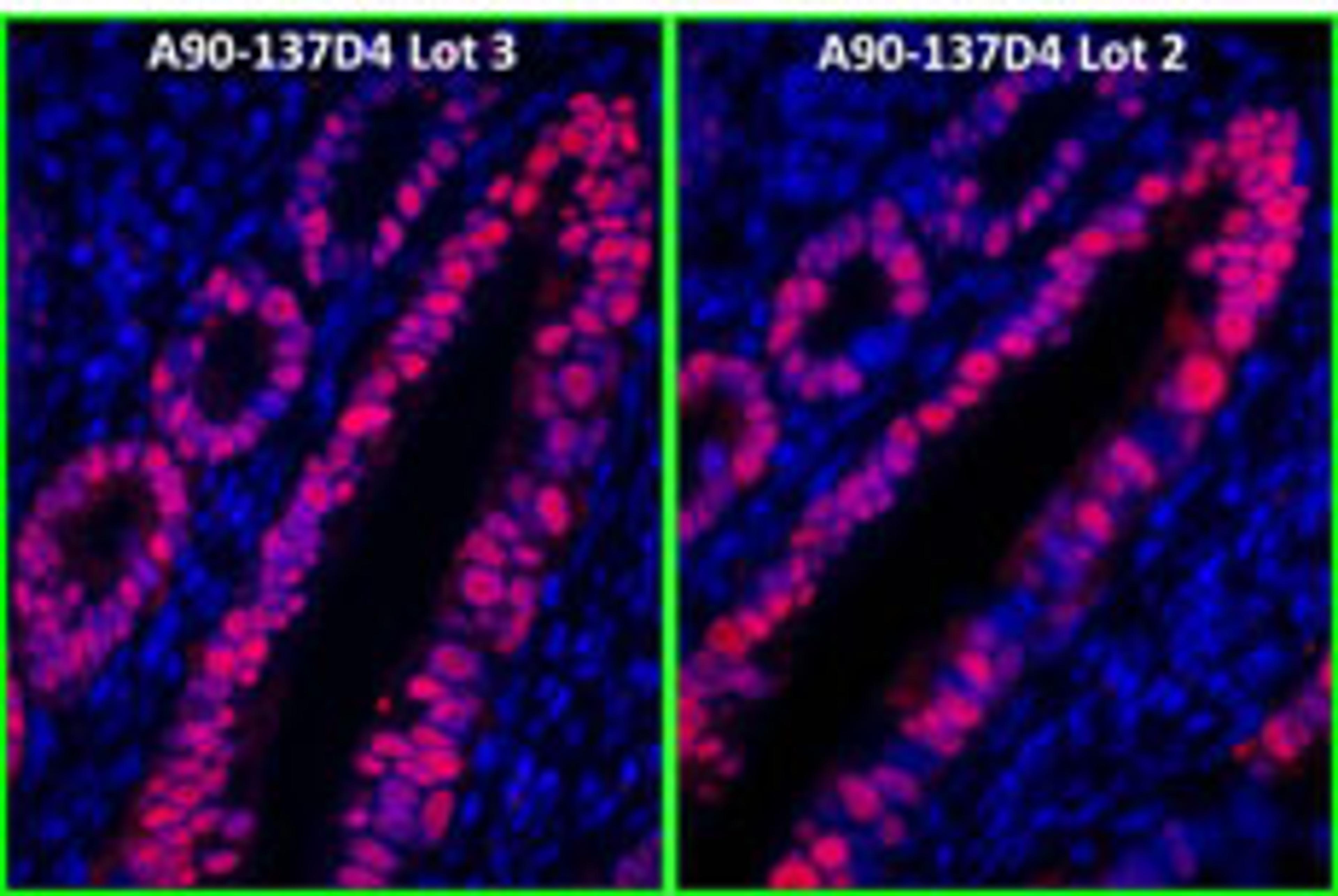 Detection of human p53 by immunofluorescence.