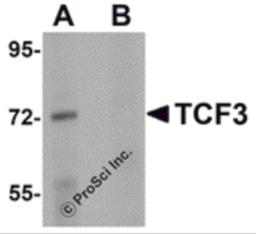 Western blot analysis of TCF3 in Human brain tissue lysate with TCF3 antibody at 1 &#956;g/mL in (A) the absence and (B) presence of peptide blocking.