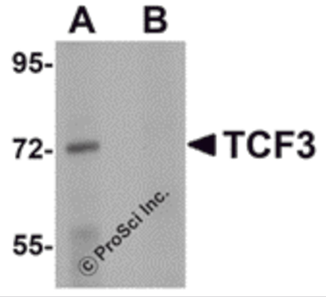 Western blot analysis of TCF3 in Human brain tissue lysate with TCF3 antibody at 1 μg/mL in (A) the absence and (B) presence of peptide blocking.