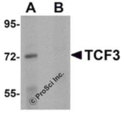 Western blot analysis of TCF3 in Human brain tissue lysate with TCF3 antibody at 1 μg/mL in (A) the absence and (B) presence of peptide blocking.