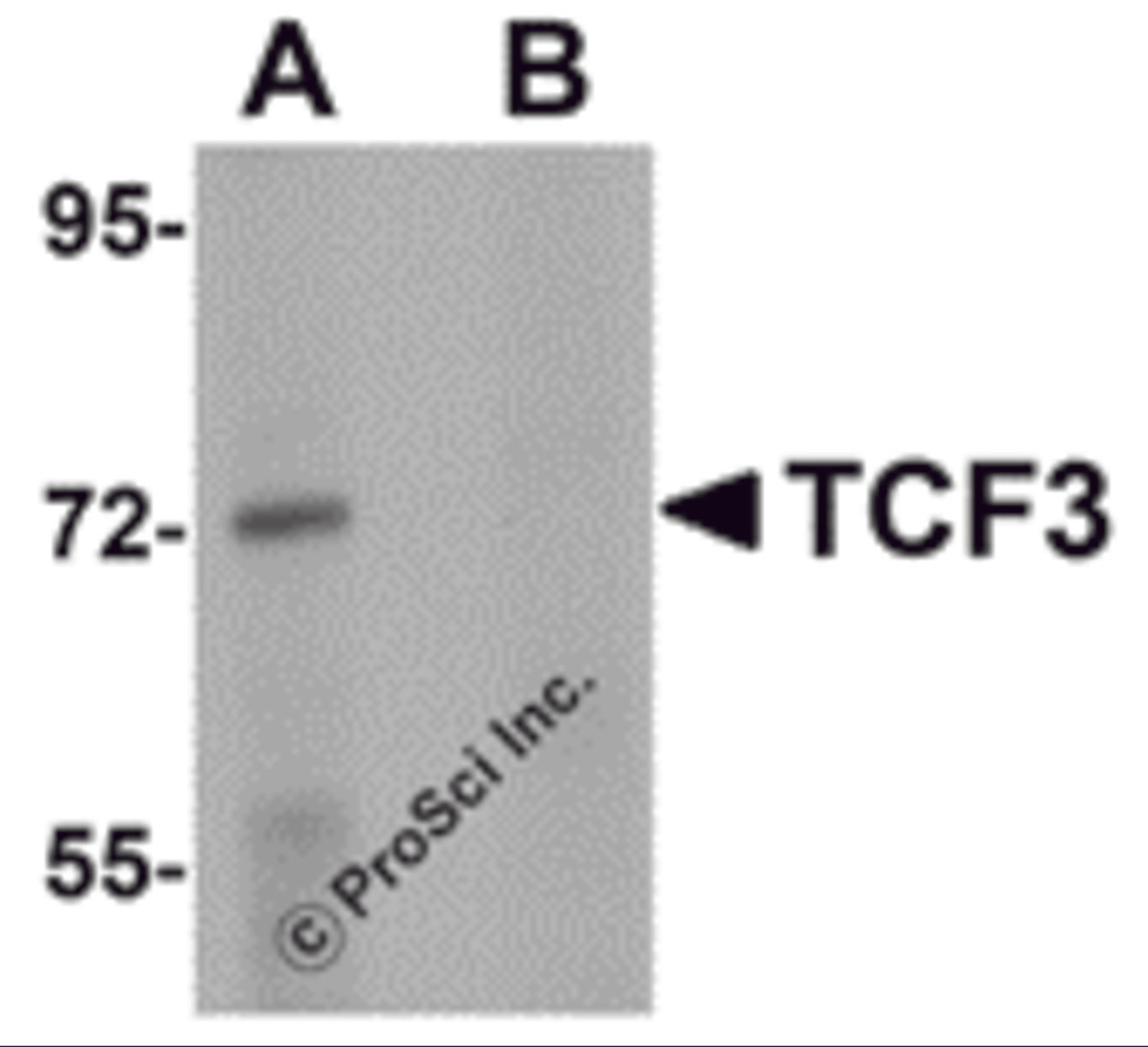 Western blot analysis of TCF3 in Human brain tissue lysate with TCF3 antibody at 1 μg/mL in (A) the absence and (B) presence of peptide blocking.