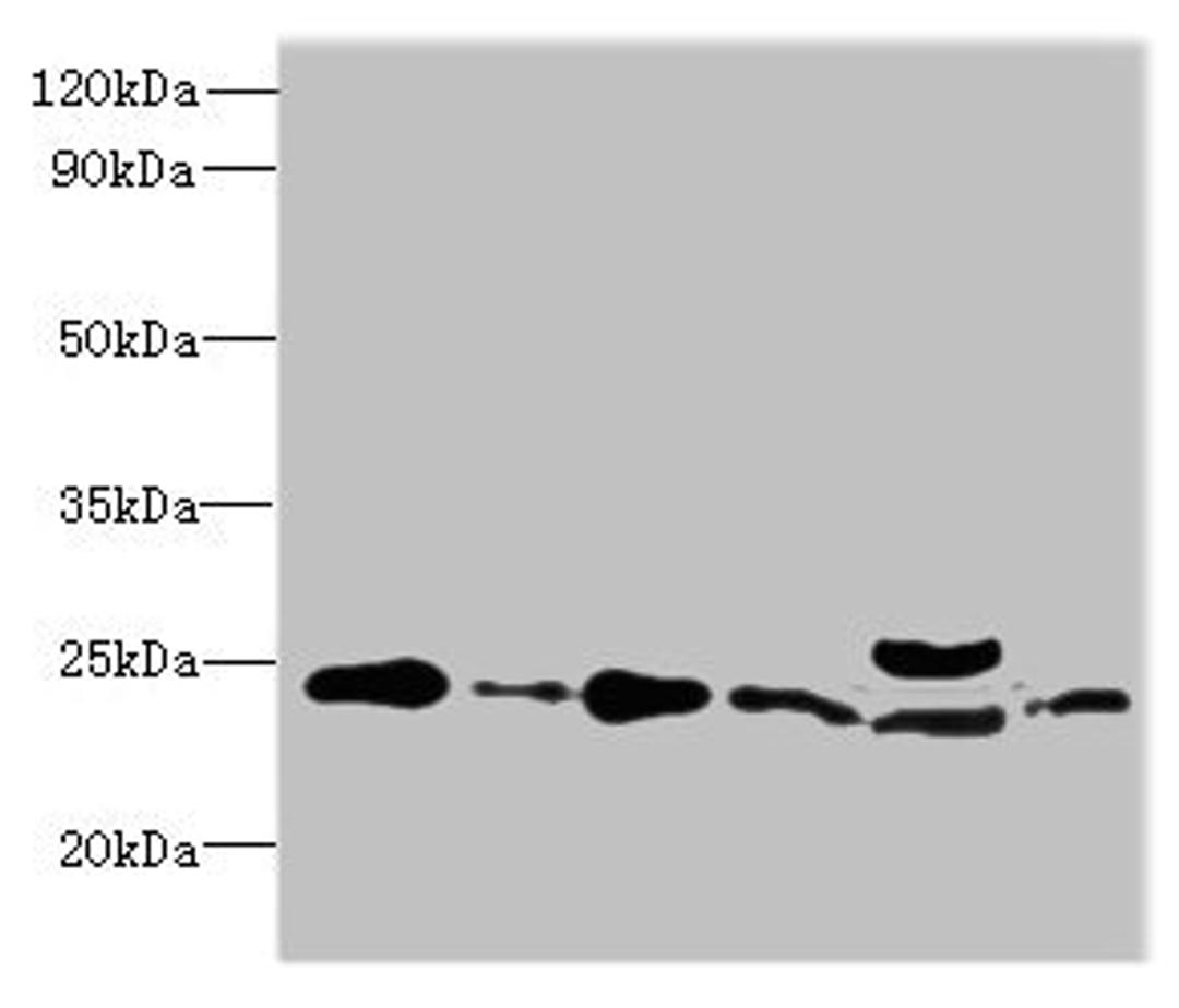 Western blot. All lanes: RPL10L antibody at 4ug/ml. Lane 1: Jurkat whole cell lysate. Lane 2: Hela whole cell lysate. Lane 3: HL60 whole cell lysate. Lane 4: K562 whole cell lysate. Lane 5: Mouse liver tissue. Lane 6: MCF-7 whole cell lysate. Secondary. Goat polyclonal to Rabbit IgG at 1/10000 dilution. Predicted band size: 25 kDa. Observed band size: 25 kDa. 