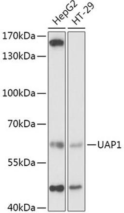 Western blot - UAP1 antibody (A2119)